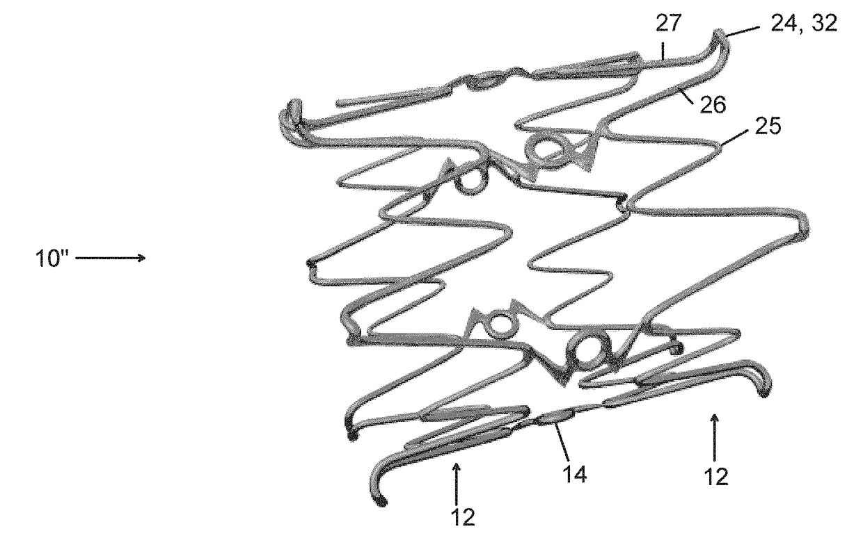 Endovascular implant