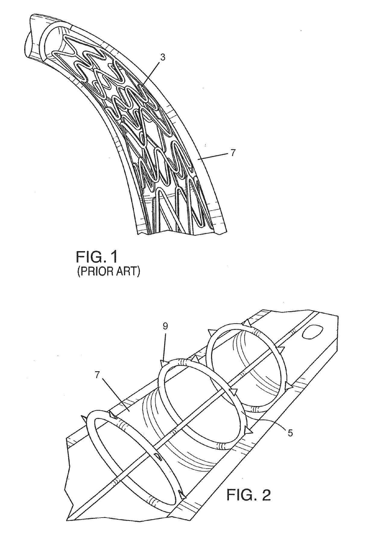 Endovascular implant