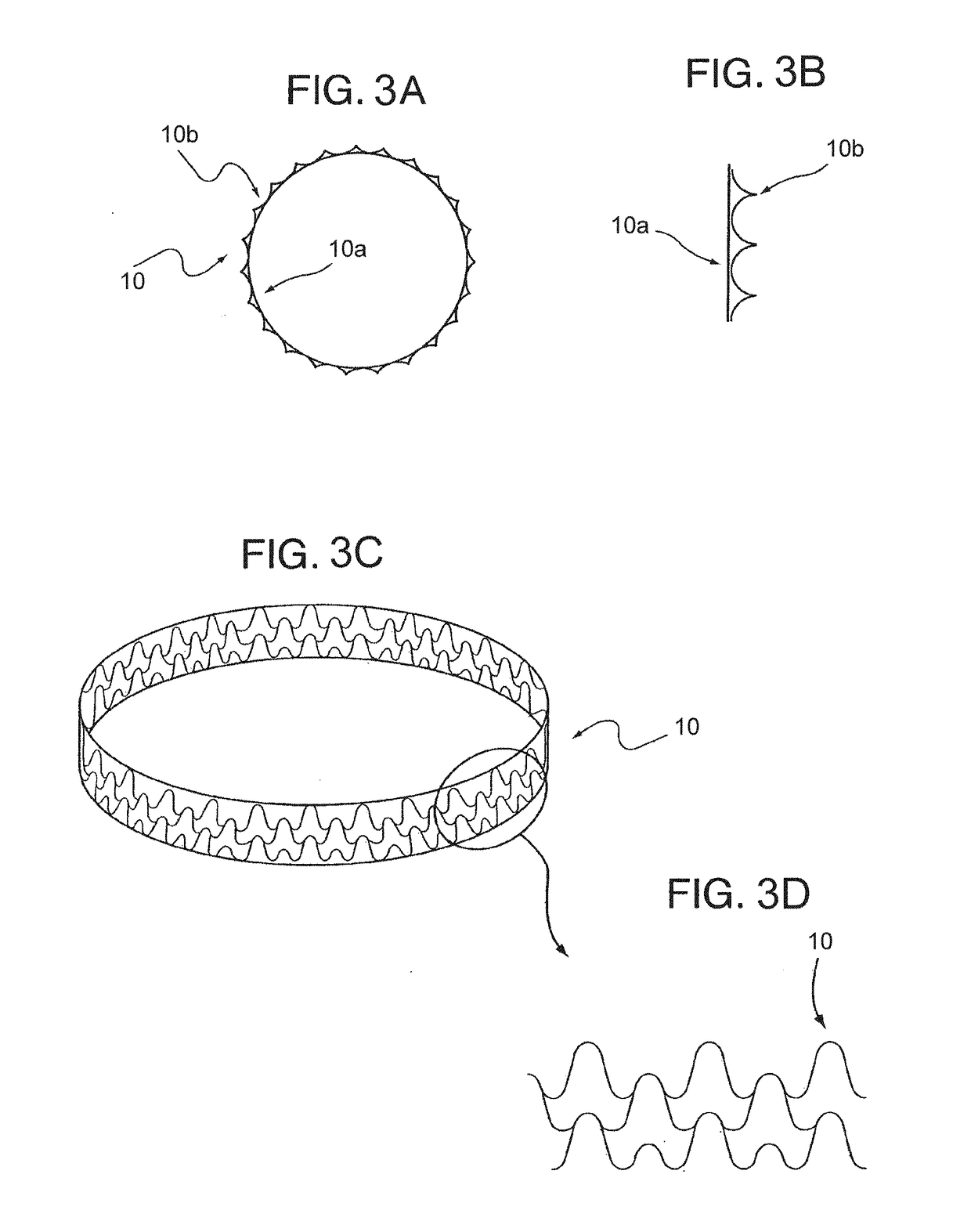 Endovascular implant