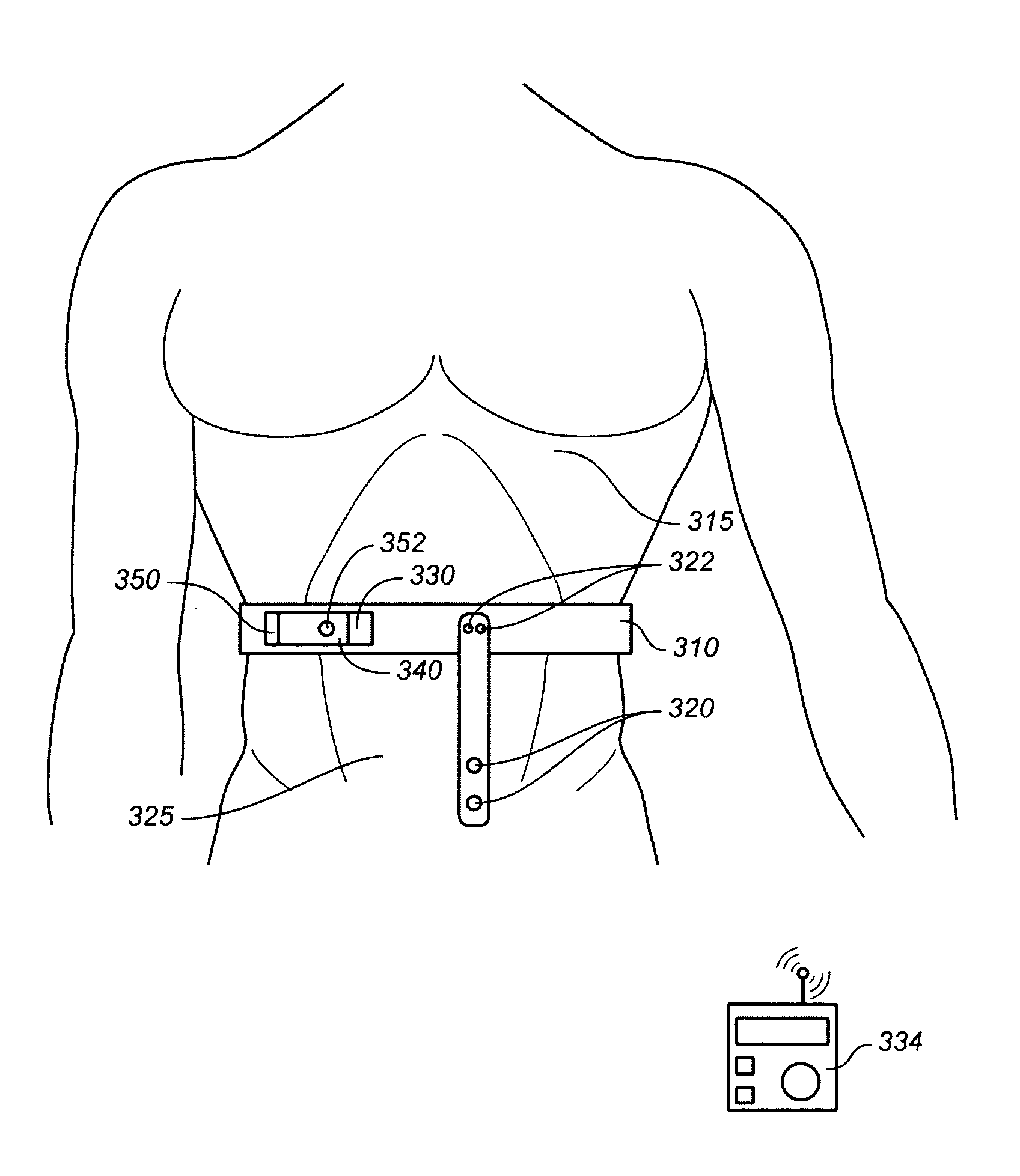 Apnea treatment device