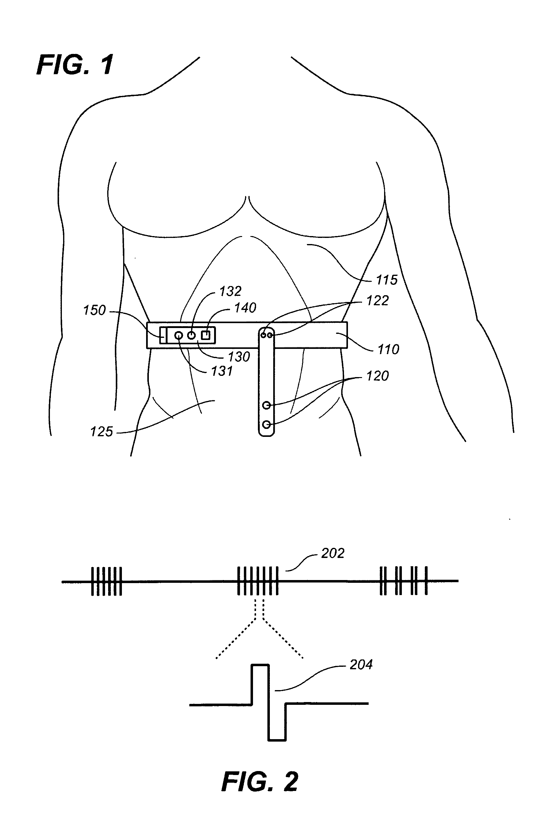 Apnea treatment device