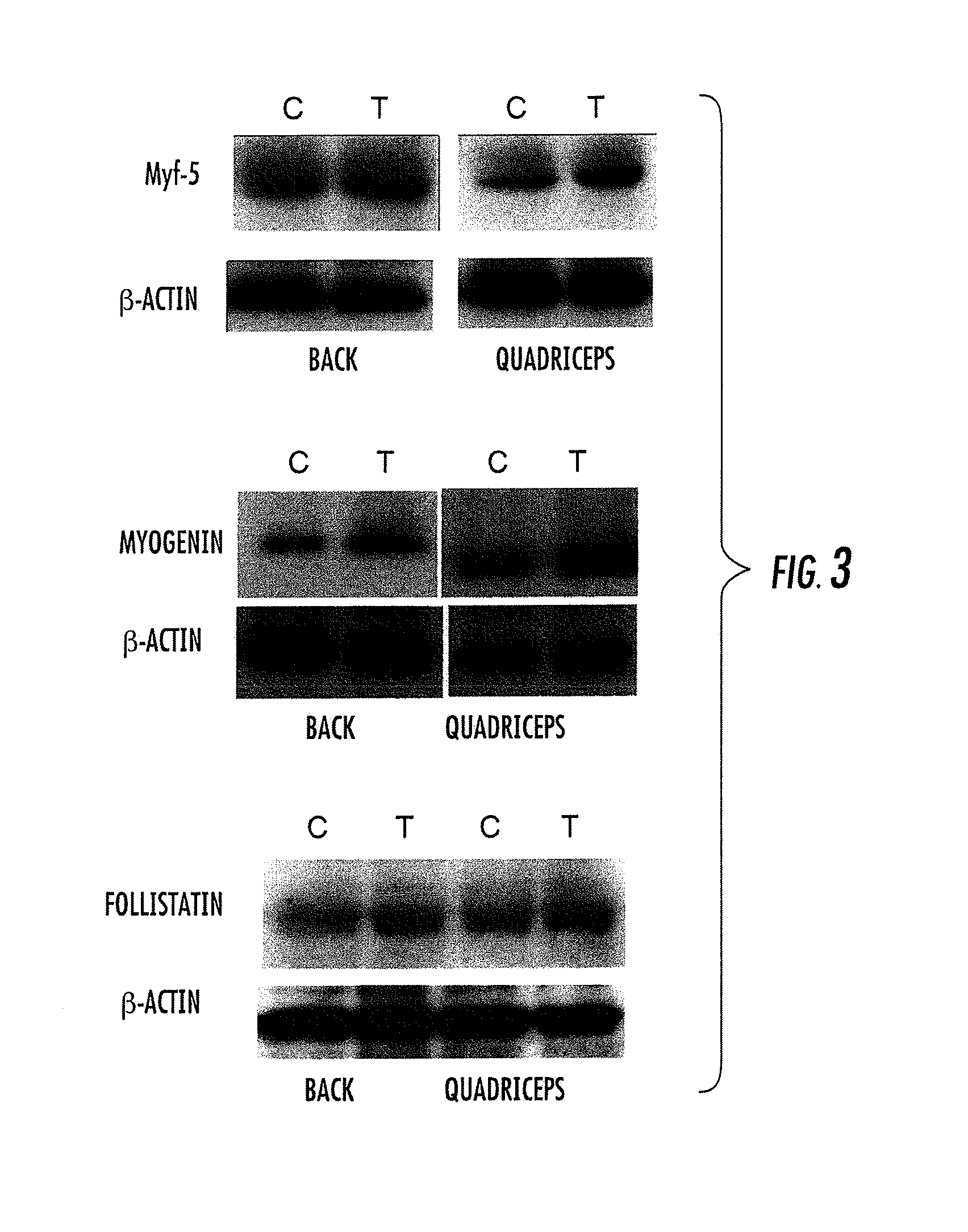 Nitrate esters and their use for the treatment of muscle and muscle related diseases