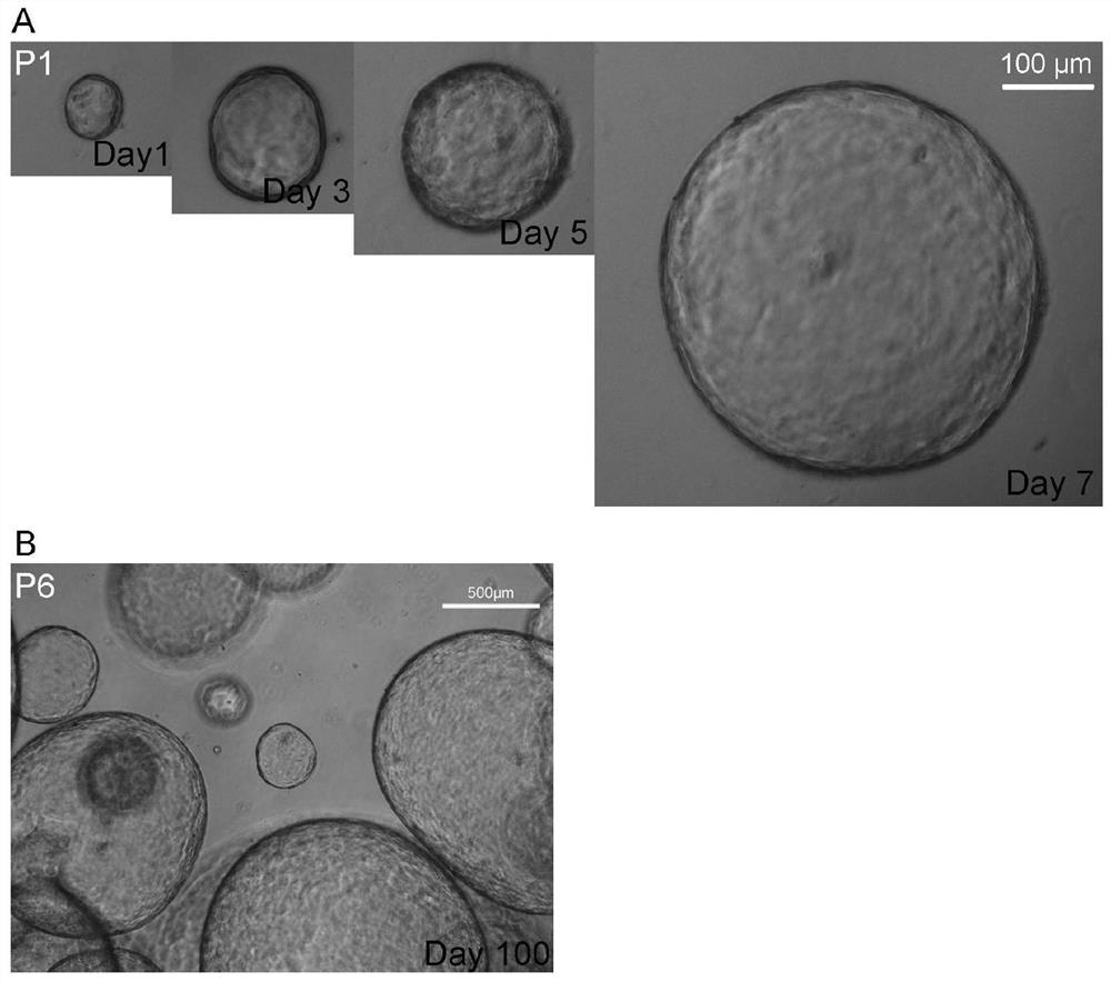 Human gallbladder stem cell acquisition and long-term in-vitro culture method