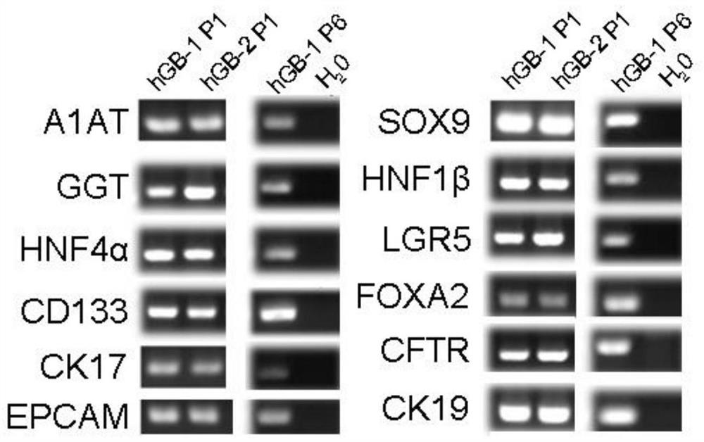 Human gallbladder stem cell acquisition and long-term in-vitro culture method