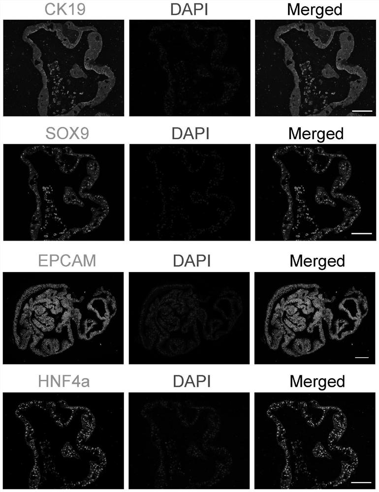 Human gallbladder stem cell acquisition and long-term in-vitro culture method