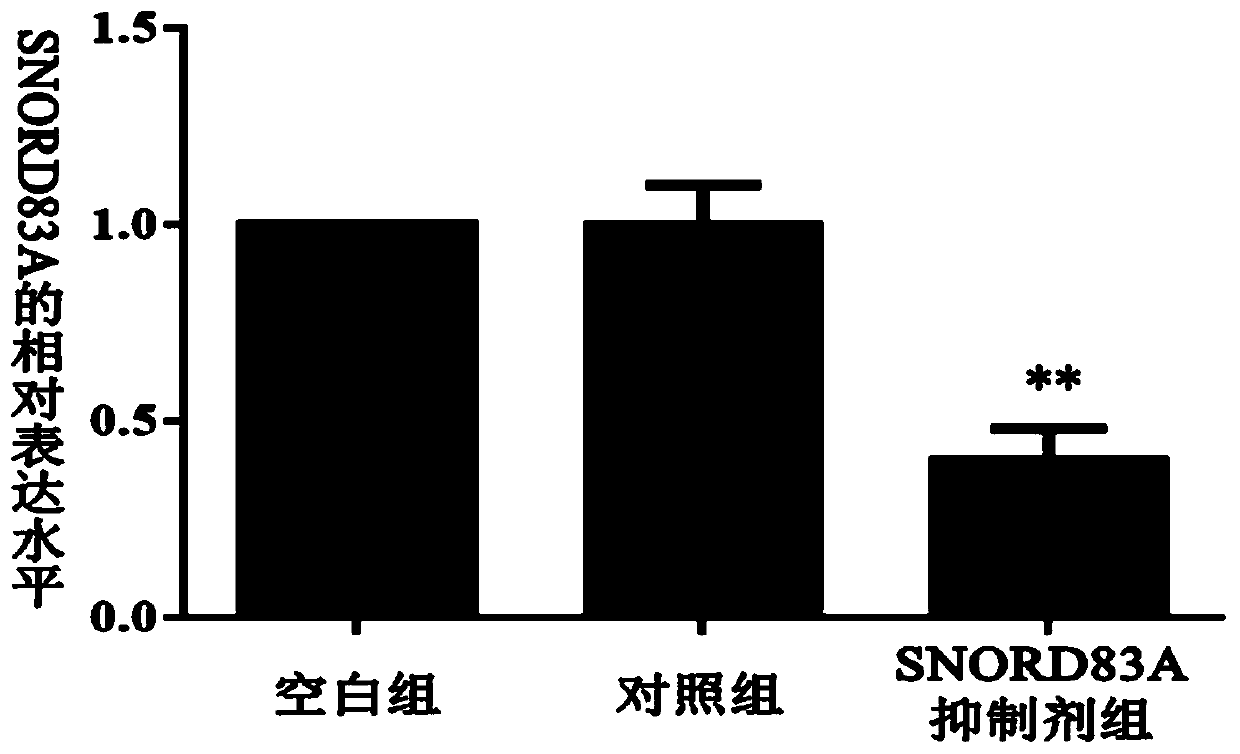 Targeted inhibitor of SNORD83A gene and application of targeted inhibitor