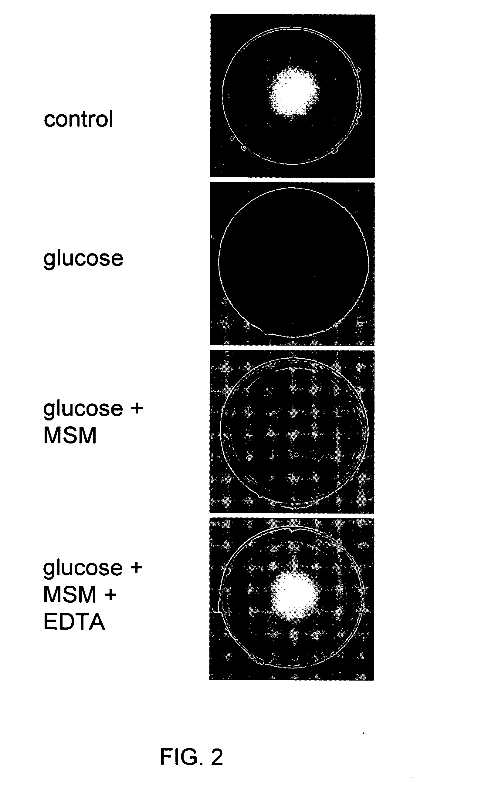 Prevention and treatment of ophthalmic complications of diabetes