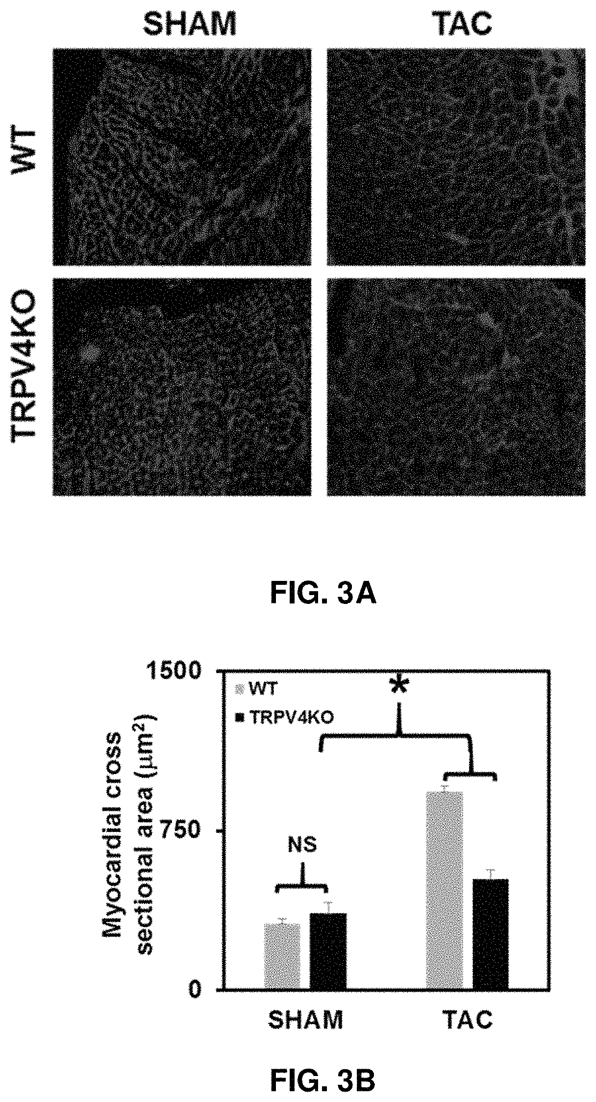 Methods for treating ischemic heart disease by targeting TRPV4