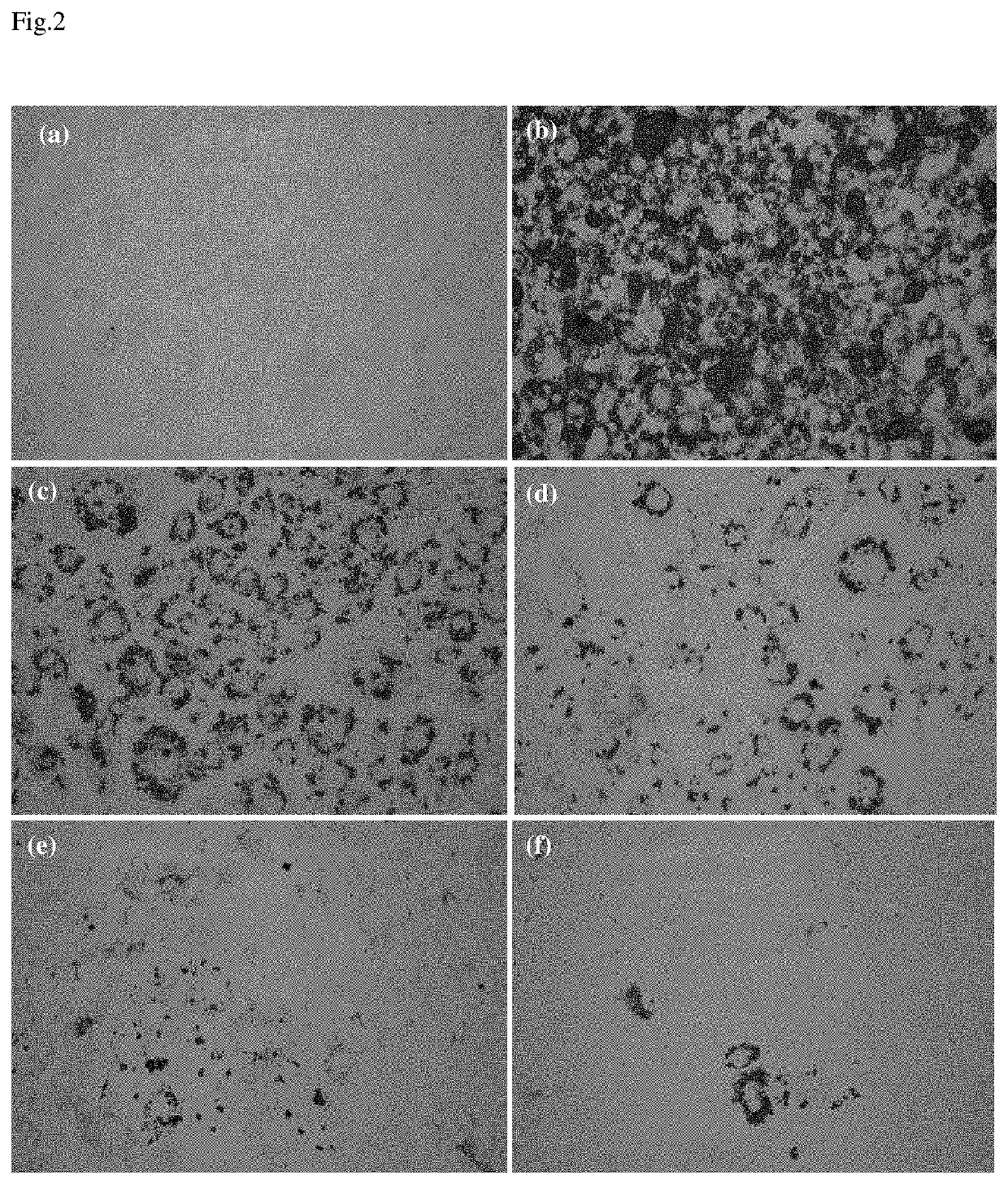 Composition for preventing or treating obesity containing ethanolic extract of <i>Ramulus mori</i>