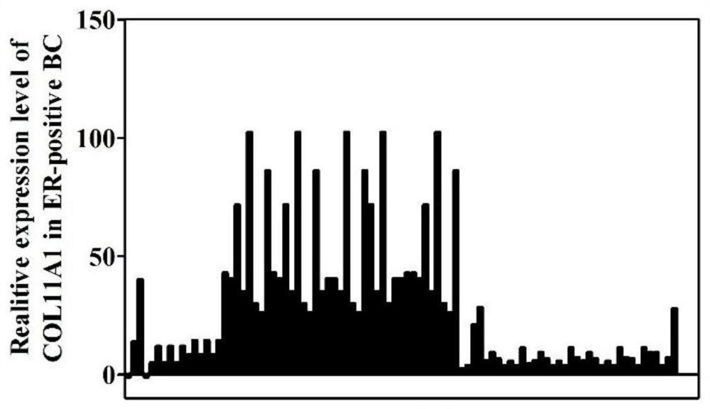Molecular marker COL11A1 and application thereof to breast cancer drugs