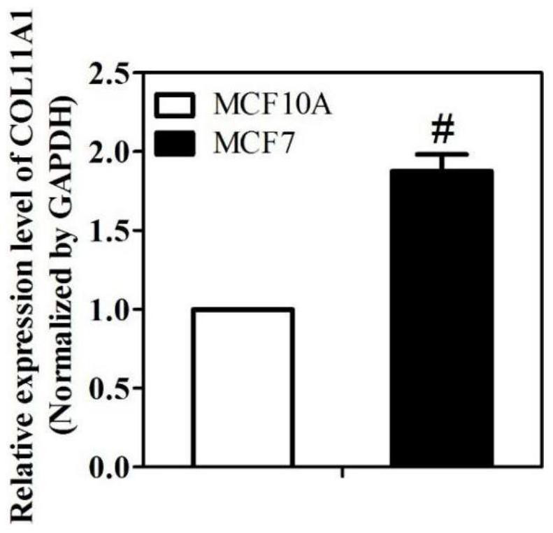 Molecular marker COL11A1 and application thereof to breast cancer drugs