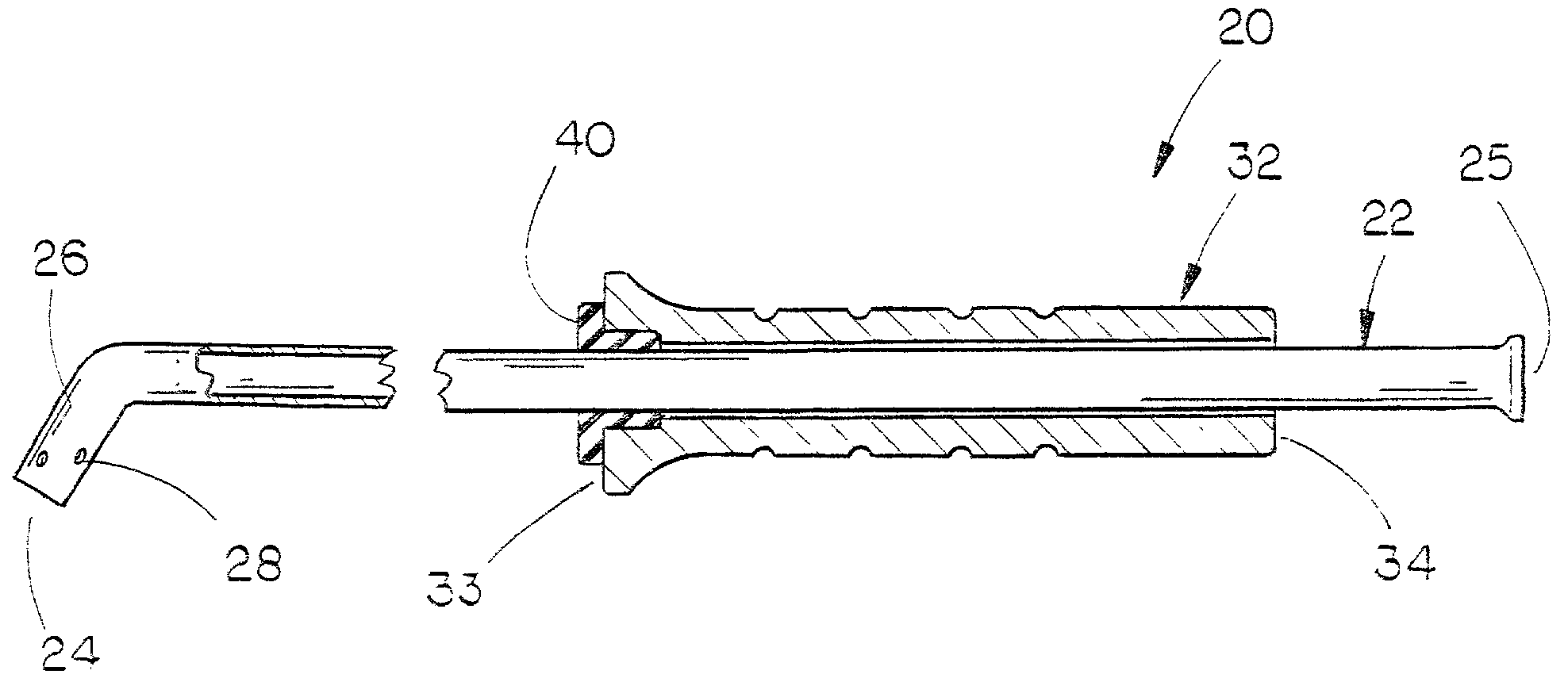 Method and means for cementing a liner onto the face of the glenoid cavity of a scapula