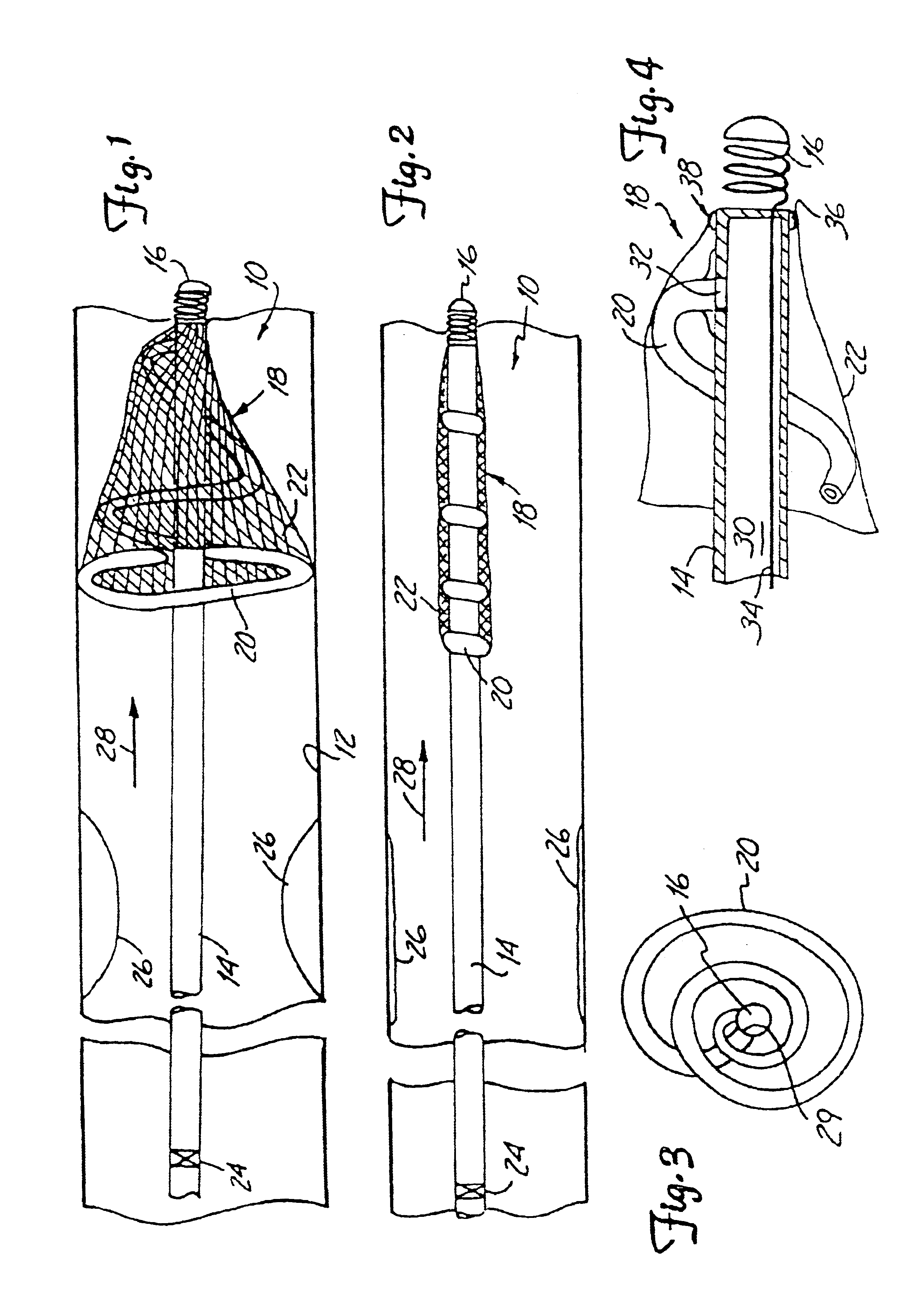 Distal protection device and method