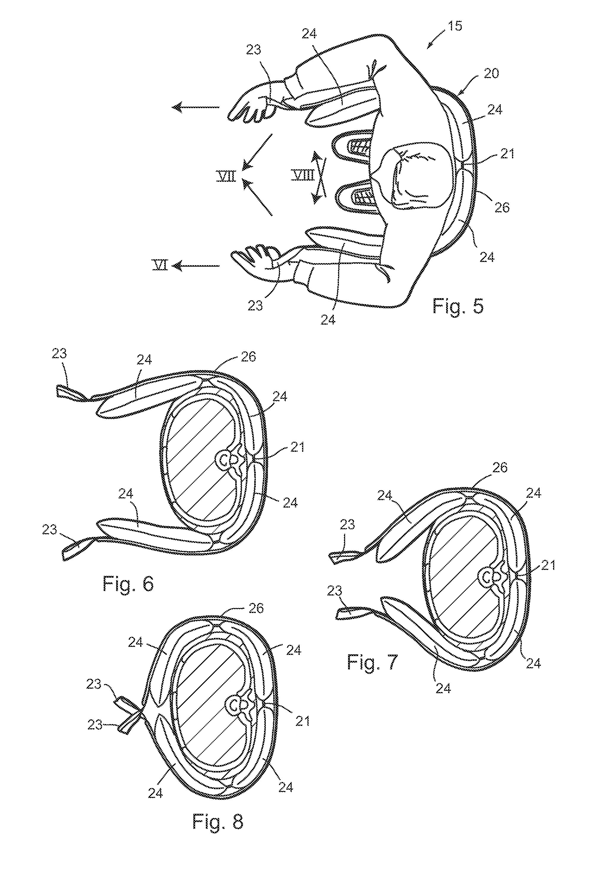 Torso compression medical device and method