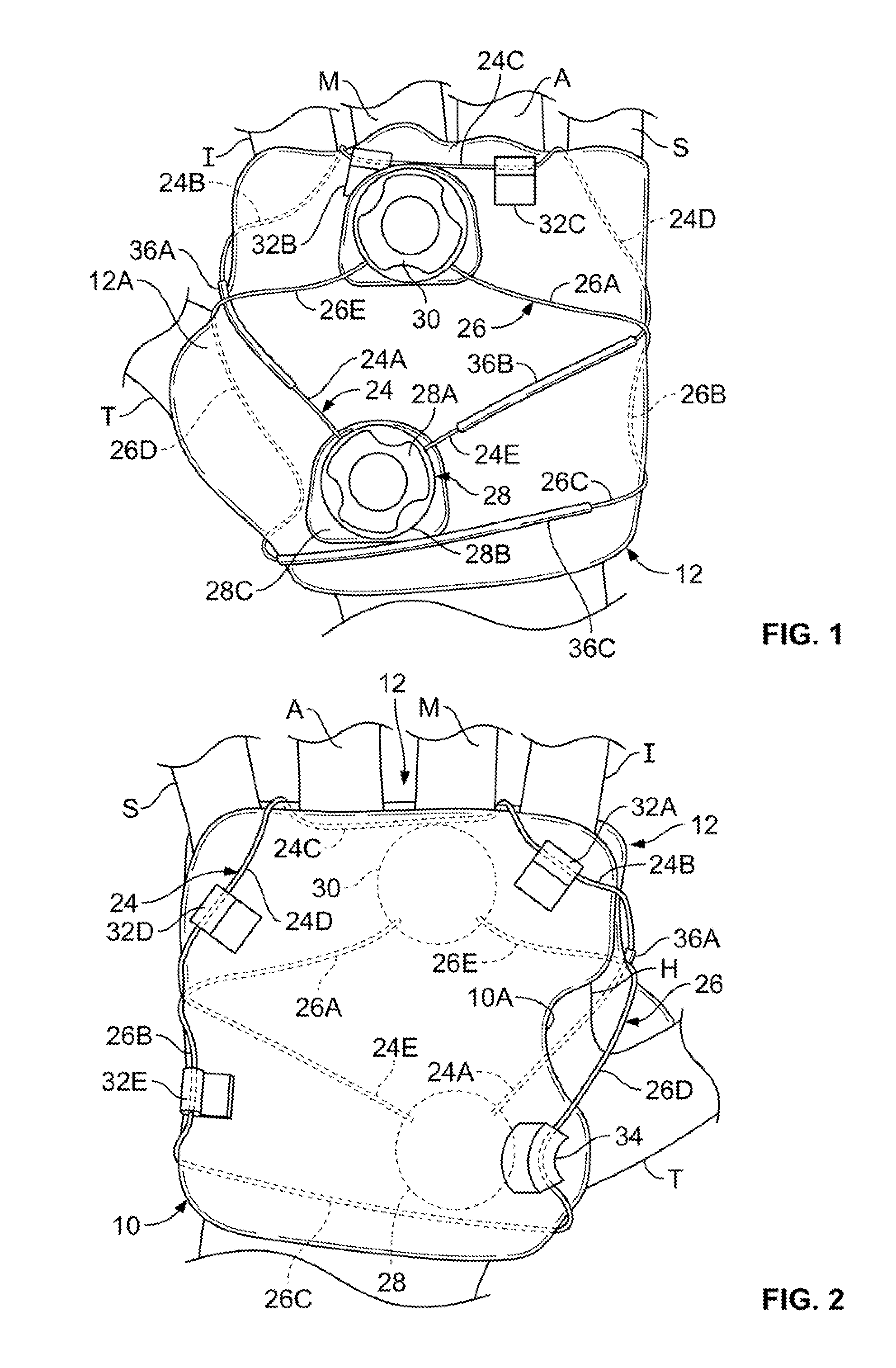 Therapeutic compression device and method