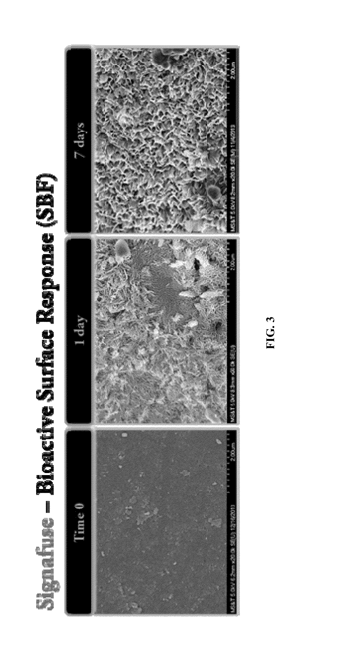 Moldable bone graft compositions