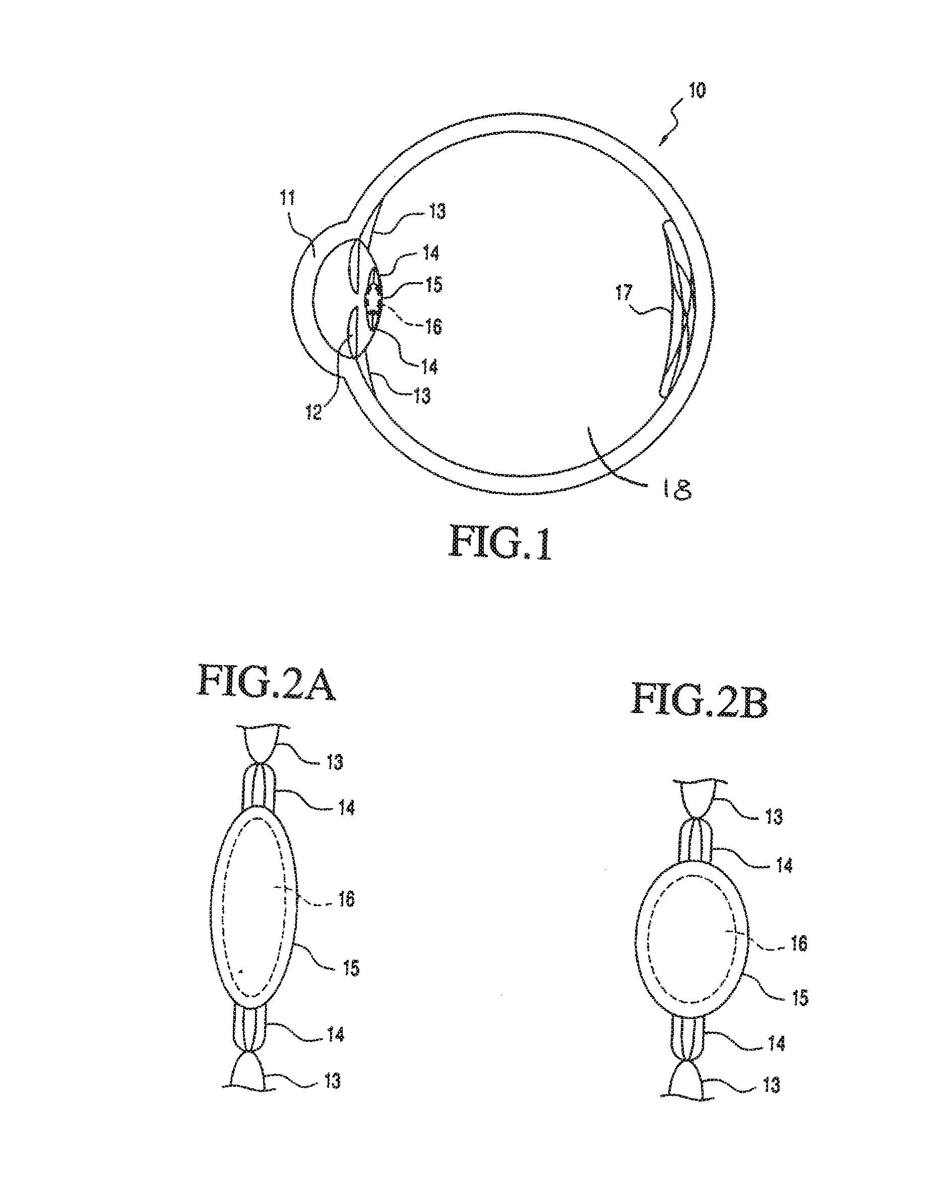 Accommodating intraocular lens system having spherical aberration compensation and method