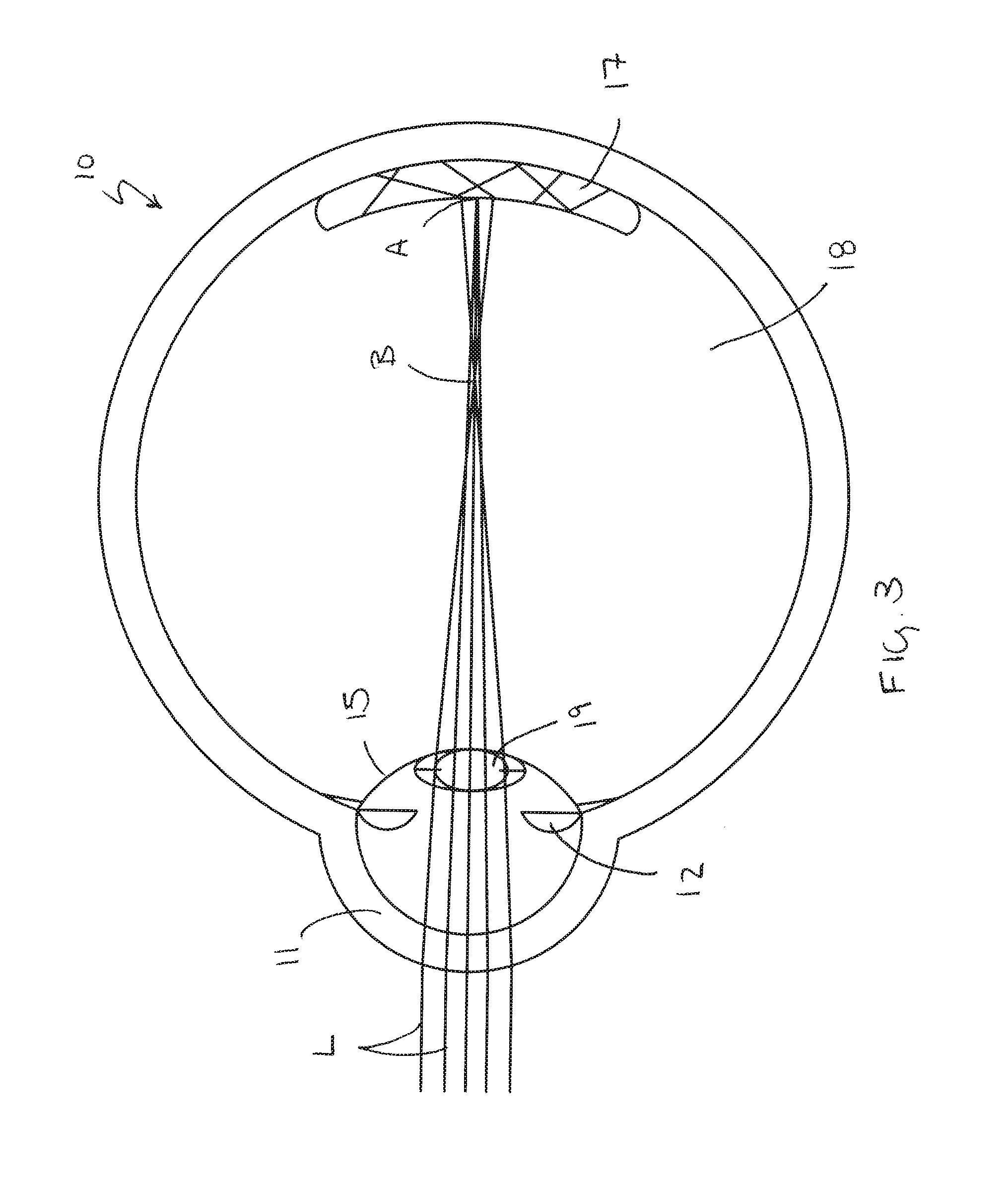 Accommodating intraocular lens system having spherical aberration compensation and method