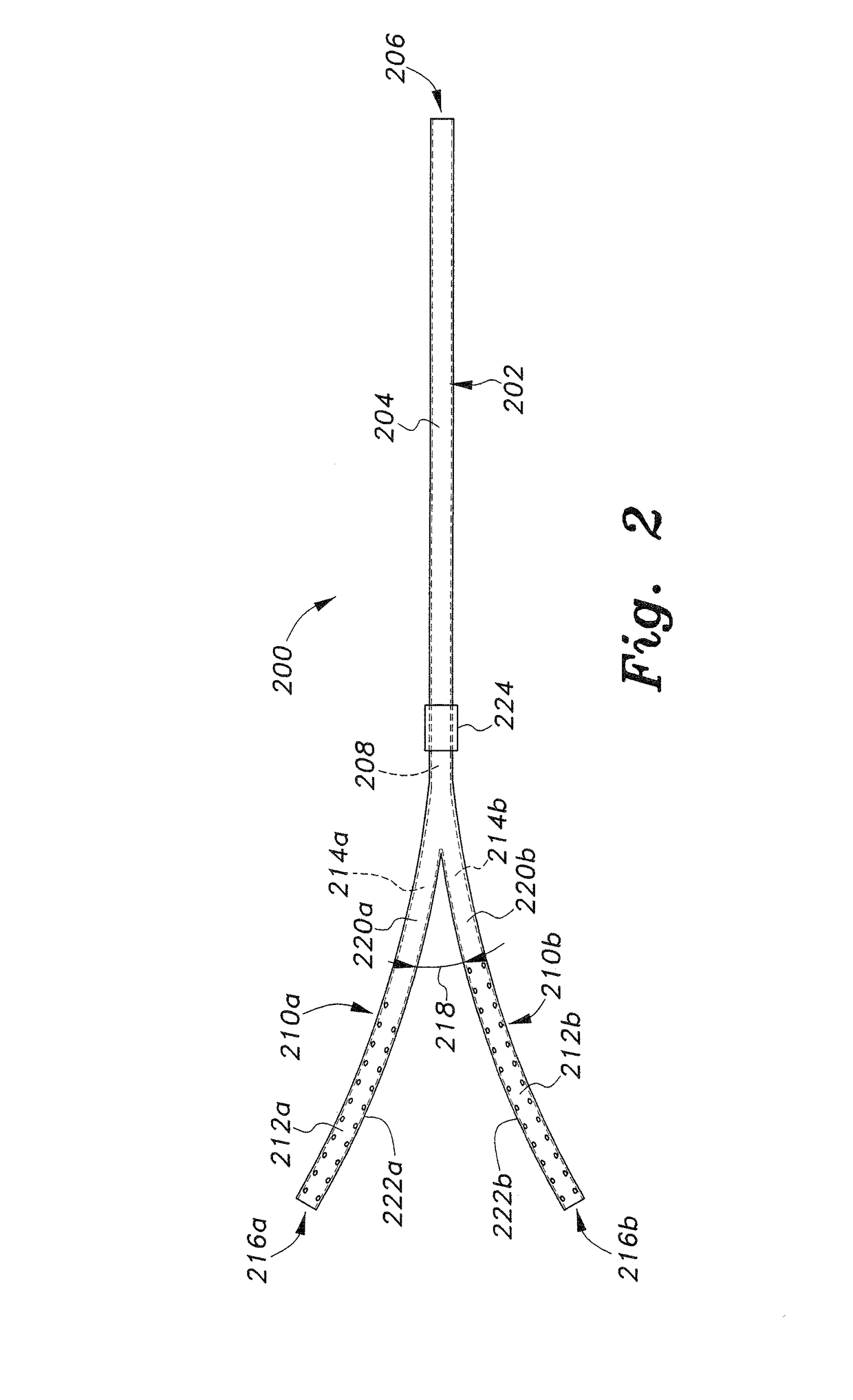 Bifurcated peritoneal catheter