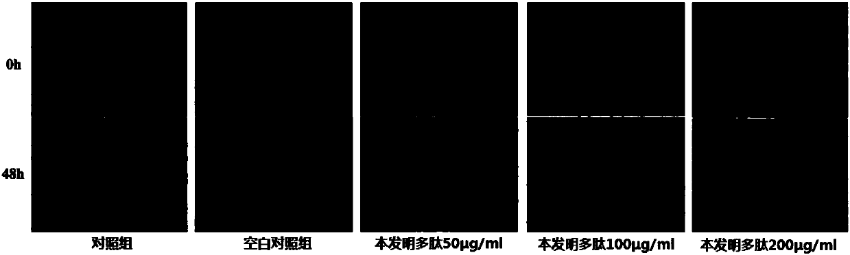 Polypeptide used for inhibiting oral squamous cell carcinoma migration and invasion capacities and application thereof