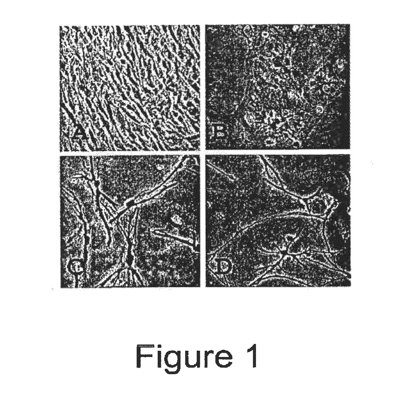 Trans-Differentiation And Re-Differentiation Of Somatic Cells And Production Of Cells For Cell Therapies