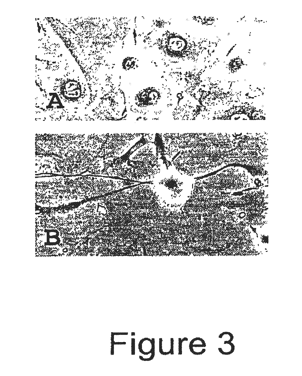 Trans-Differentiation And Re-Differentiation Of Somatic Cells And Production Of Cells For Cell Therapies