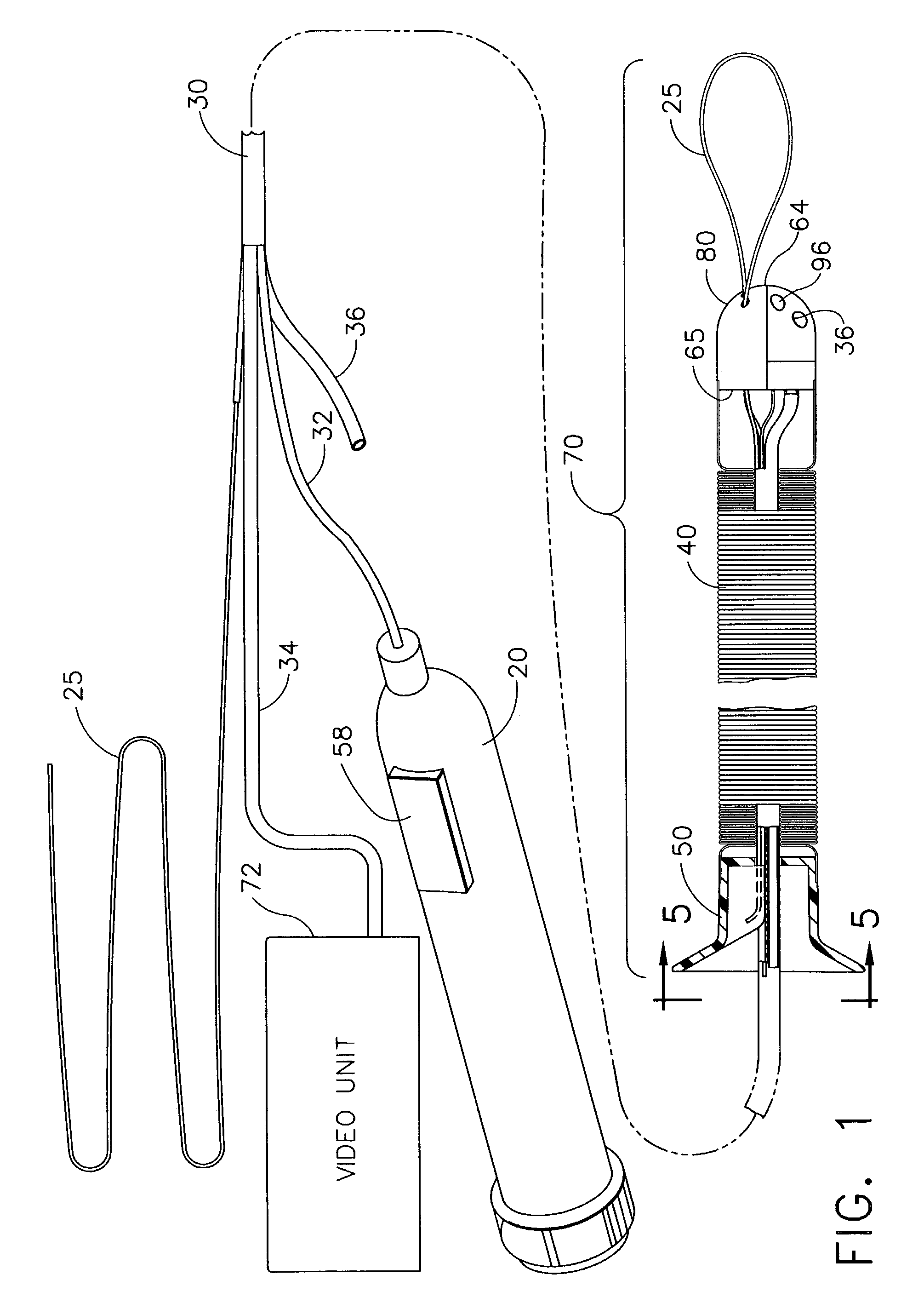 Locally-propelled, intraluminal device with cable loop track and method of use