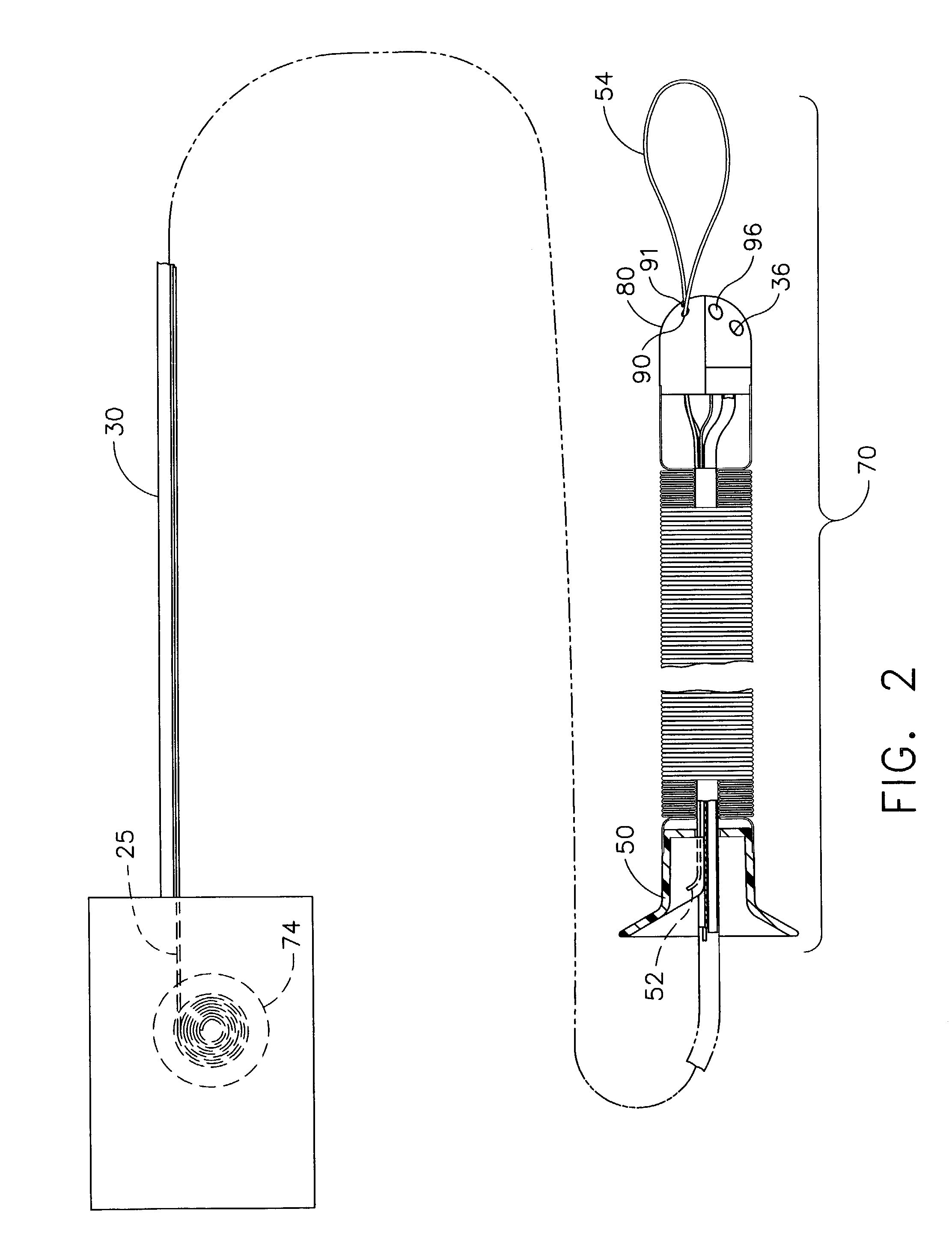 Locally-propelled, intraluminal device with cable loop track and method of use