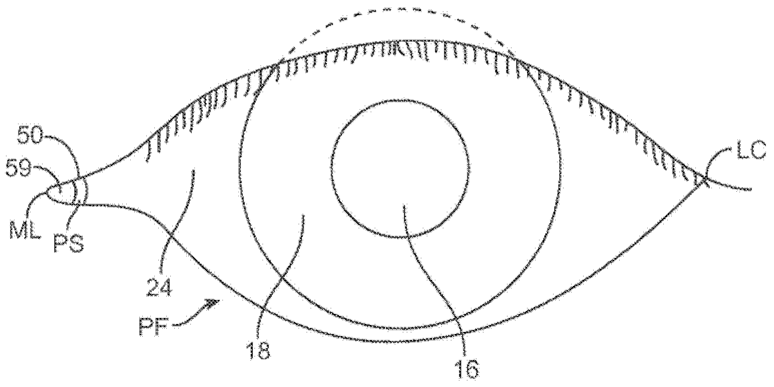 Ocular insert apparatus and methods