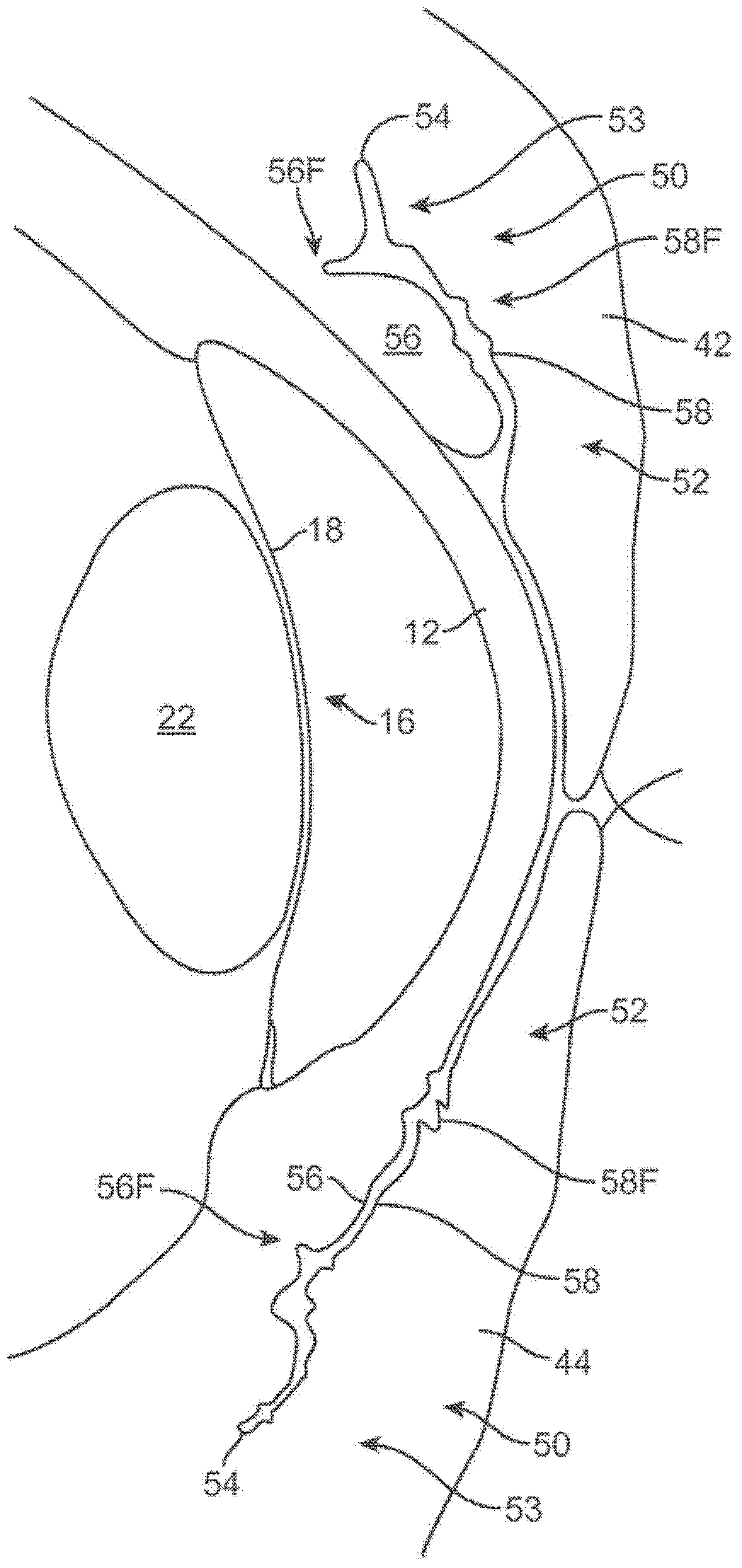 Ocular insert apparatus and methods