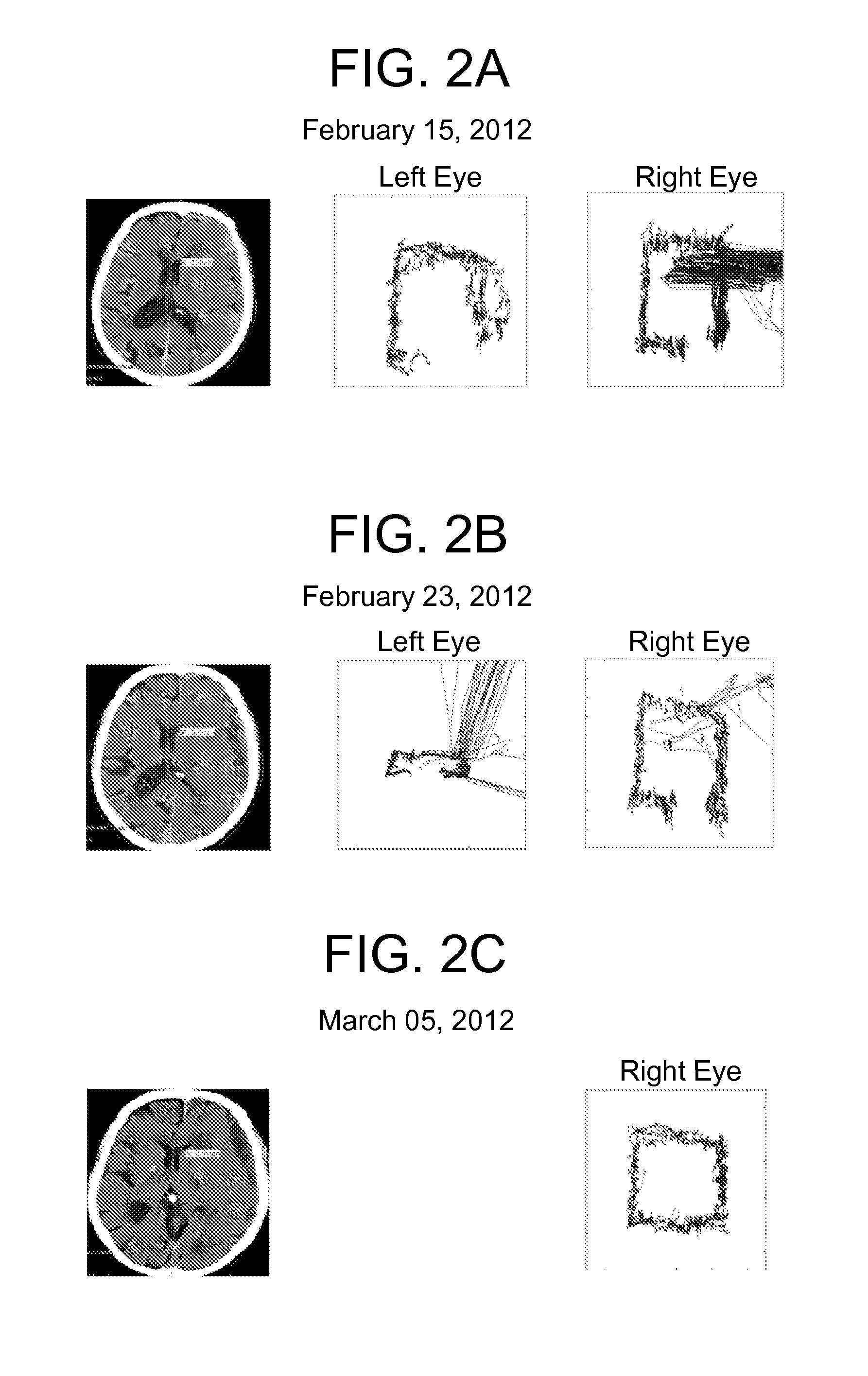 Methods and kits for assessing central nervous system integrity