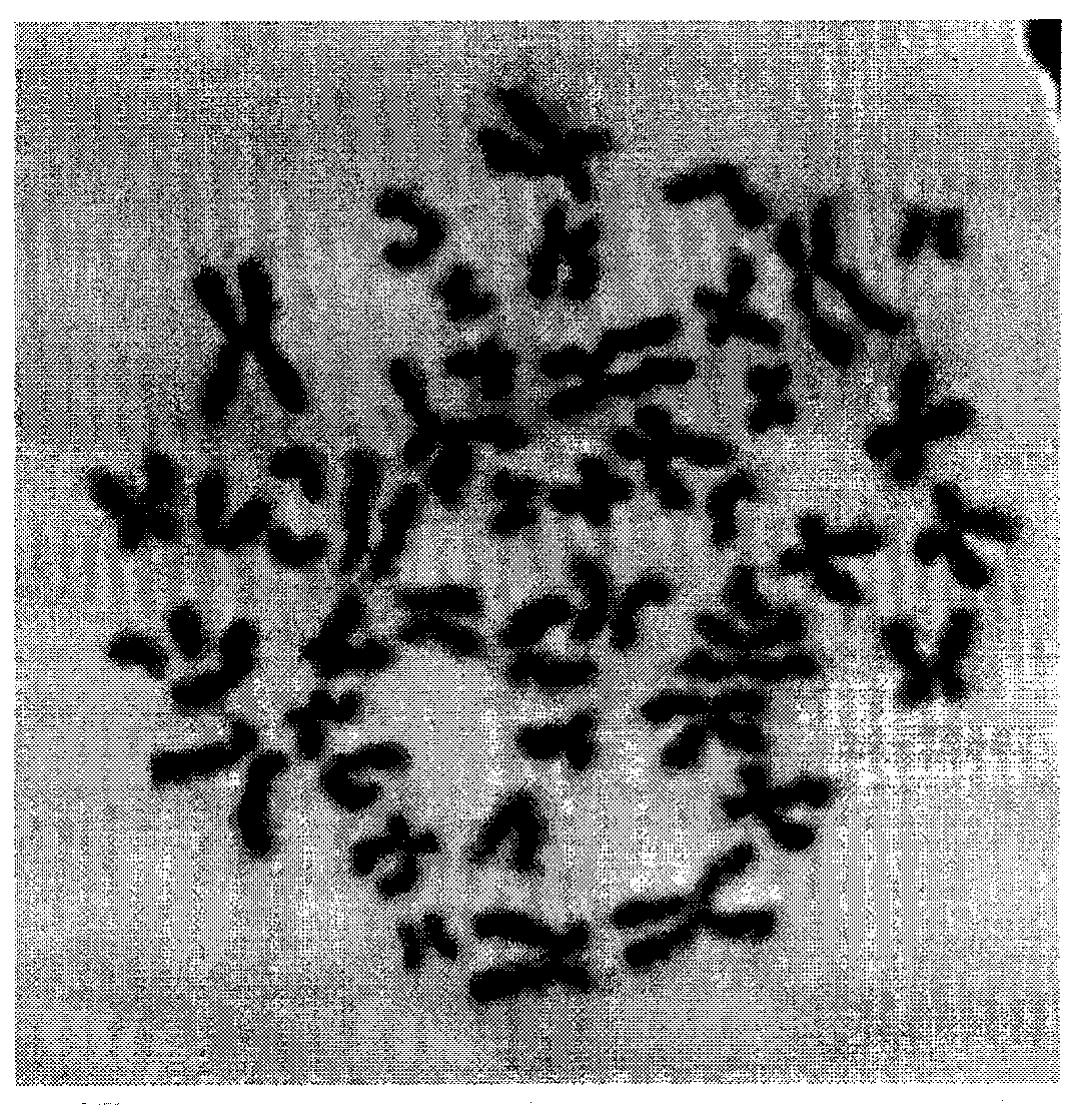 Method for rapidly preparing prematurely condensed chromosomes of human peripheral blood lymphocytes