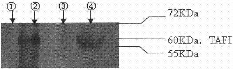 In vitro detection kit for TAFI content