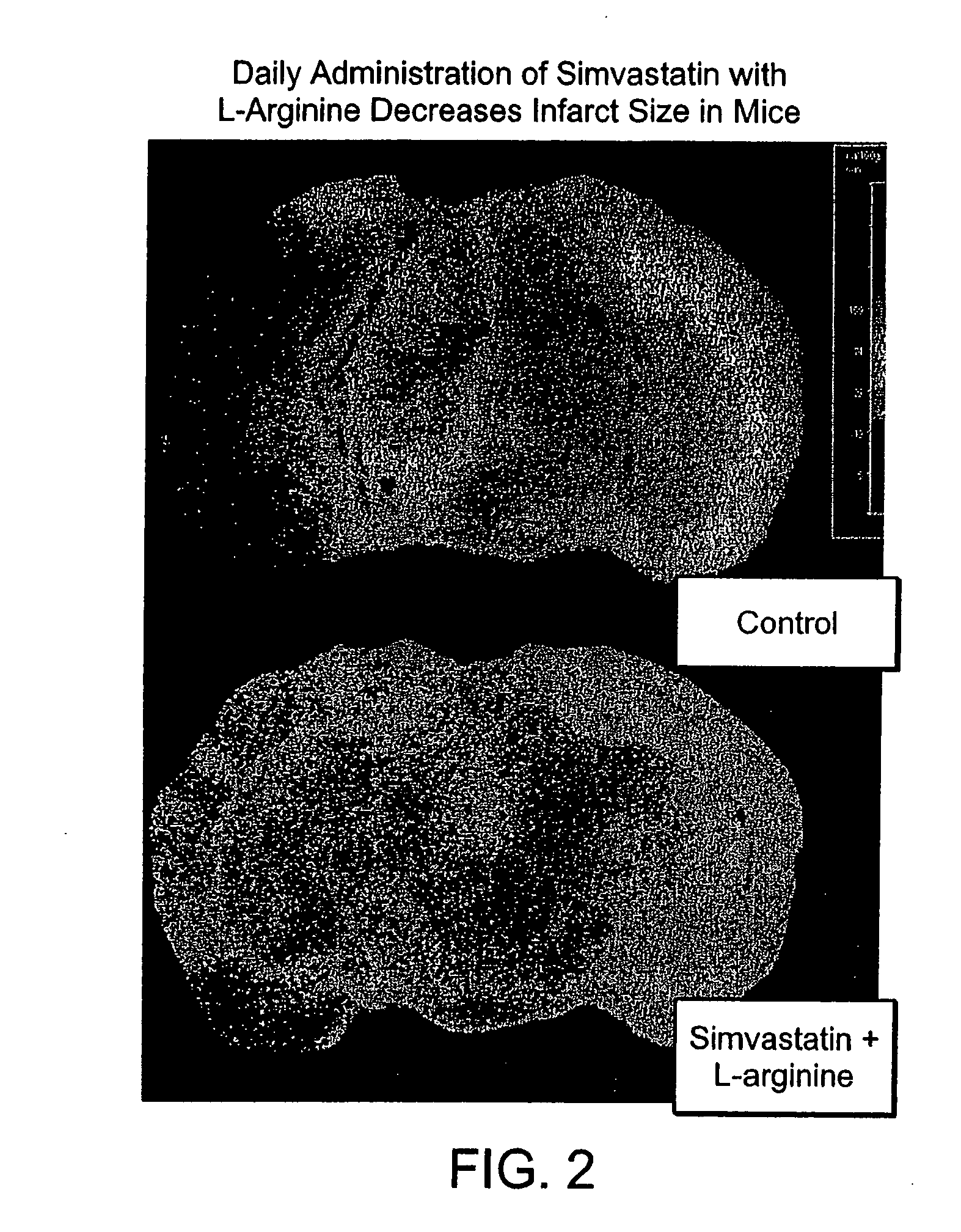 Sustained release L-arginine formulations and methods of manufacture and use