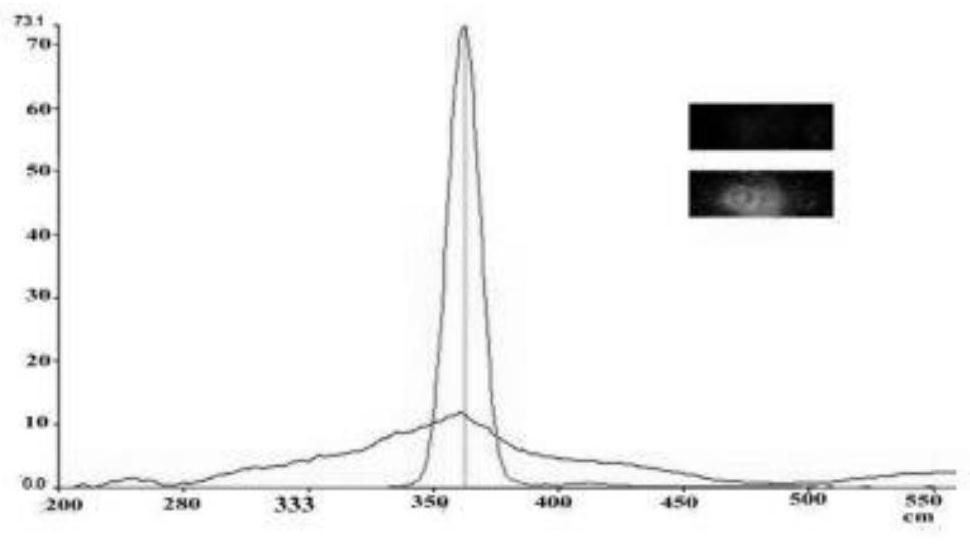 Preparation method of nanometer targeted drug, and application of nanometer targeted drug for treating gastric carcinoma