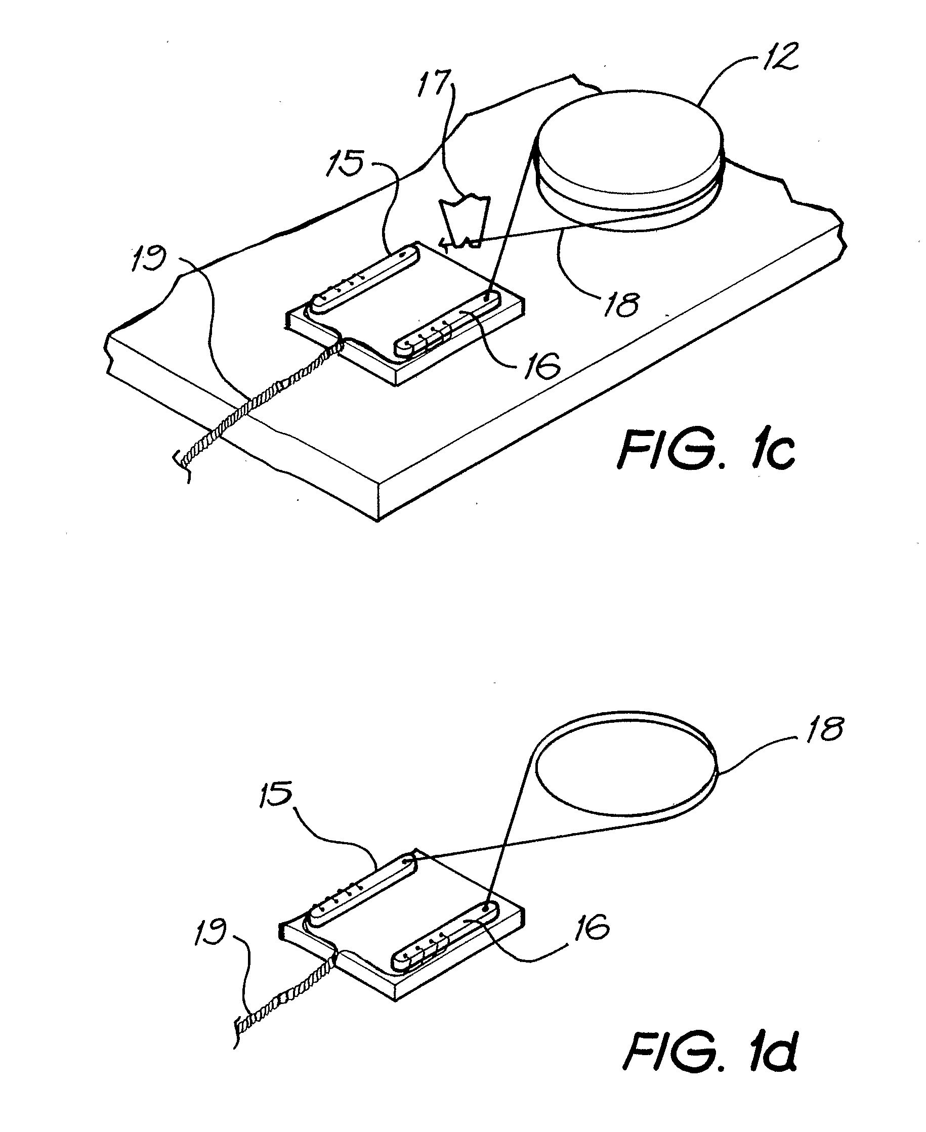 Cochlear implant assembly