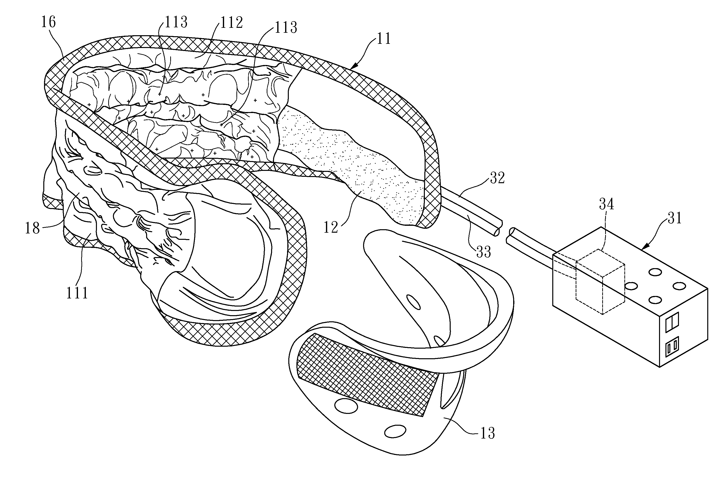 Capsular bag rehabilitation device