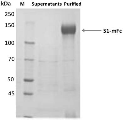 Human antibody binding to coronavirus RBD and application of human antibody