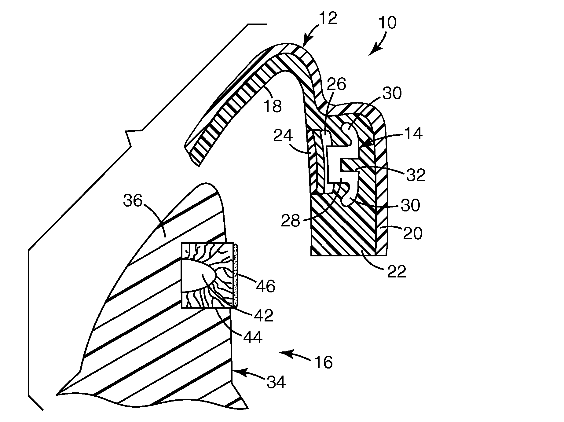 Orthodontic adhesive dispensing assembly