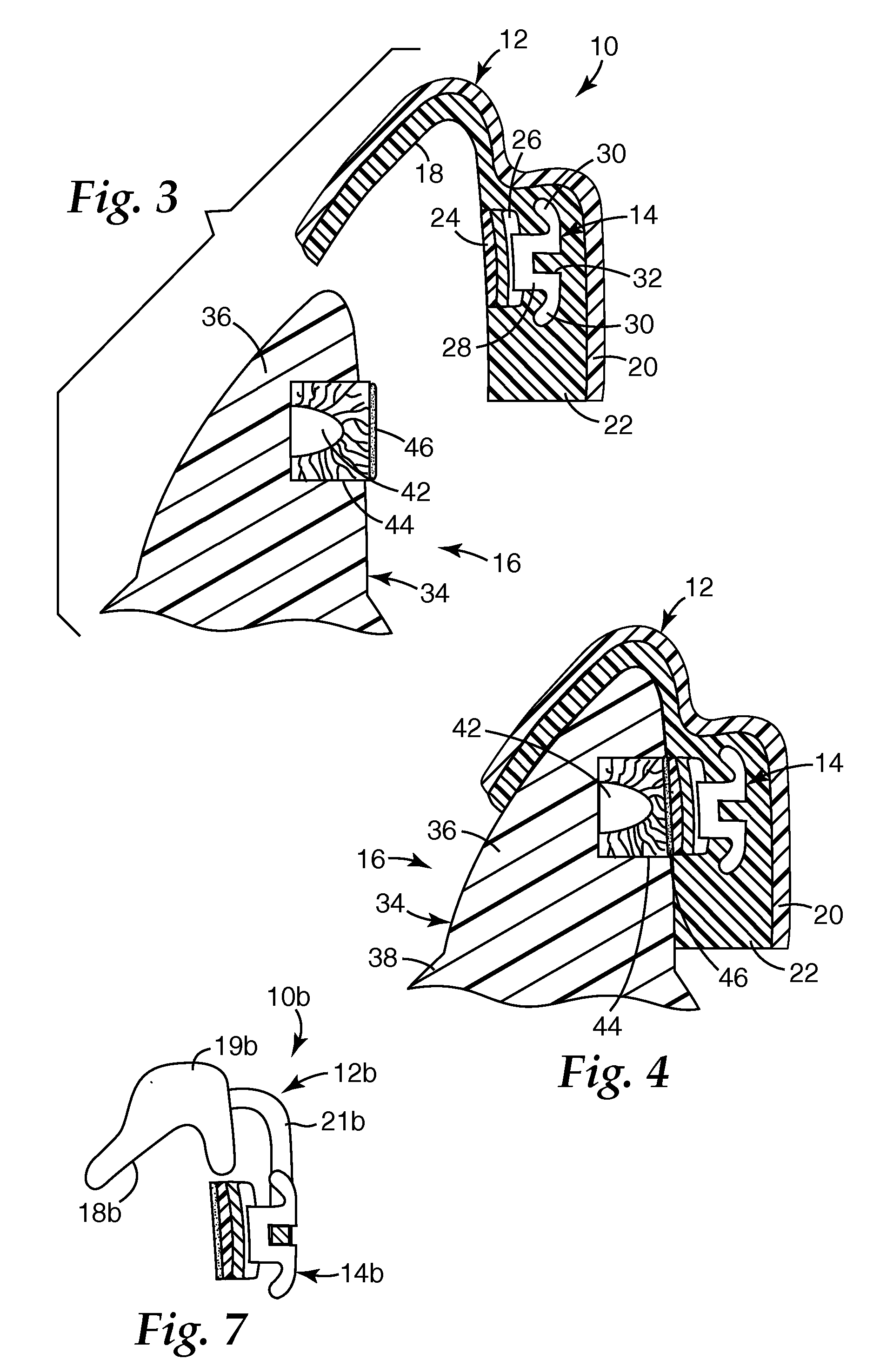 Orthodontic adhesive dispensing assembly