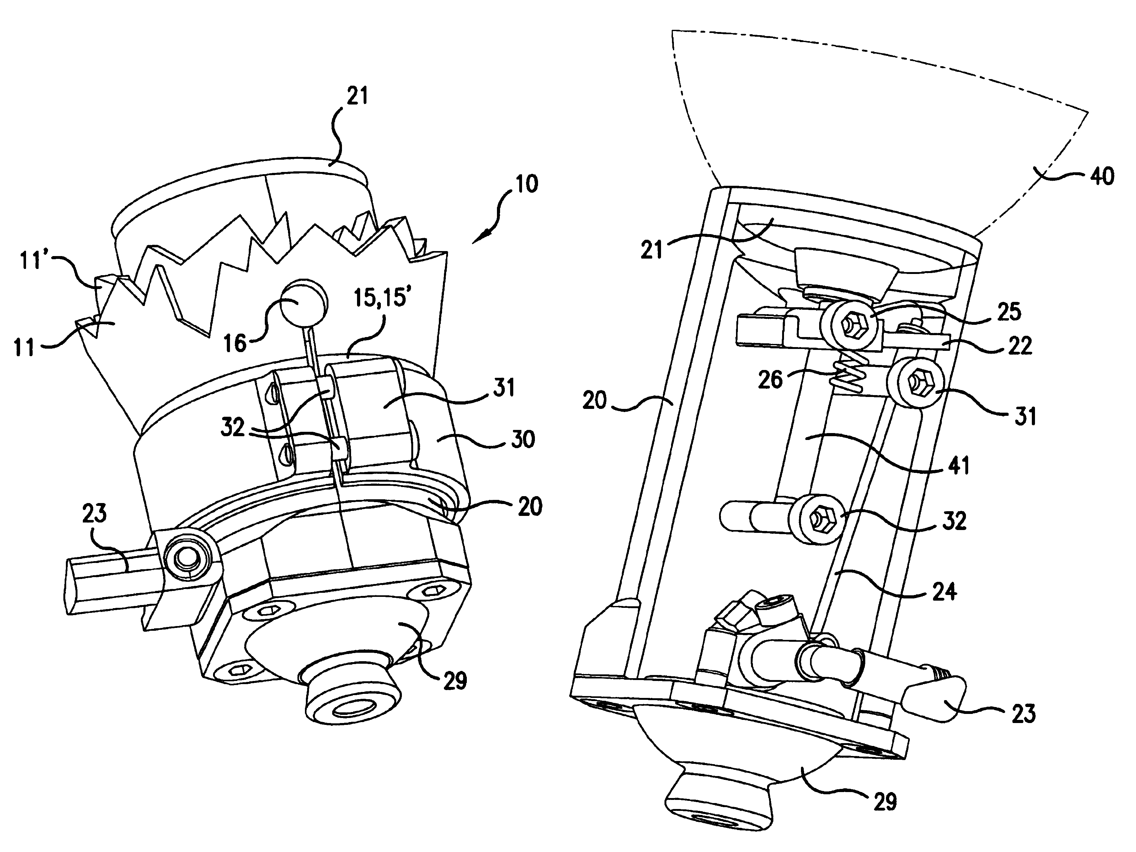 Prosthesis