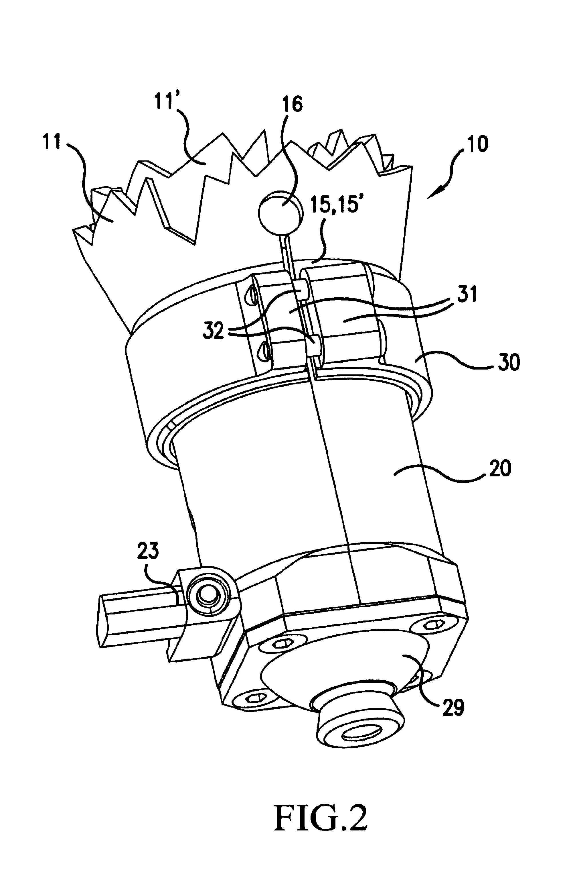 Prosthesis