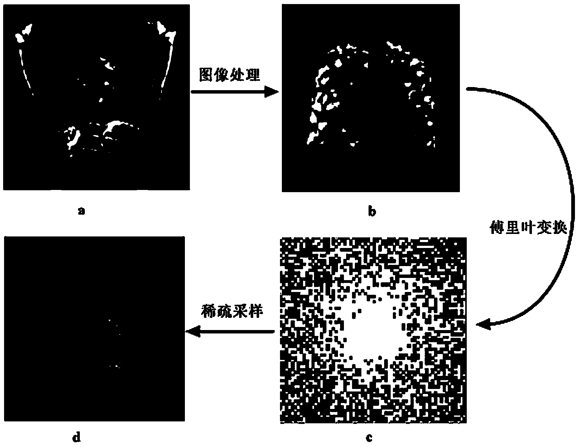 Lung rapid magnetic resonance imaging method based on prior knowledge and sparse sampling