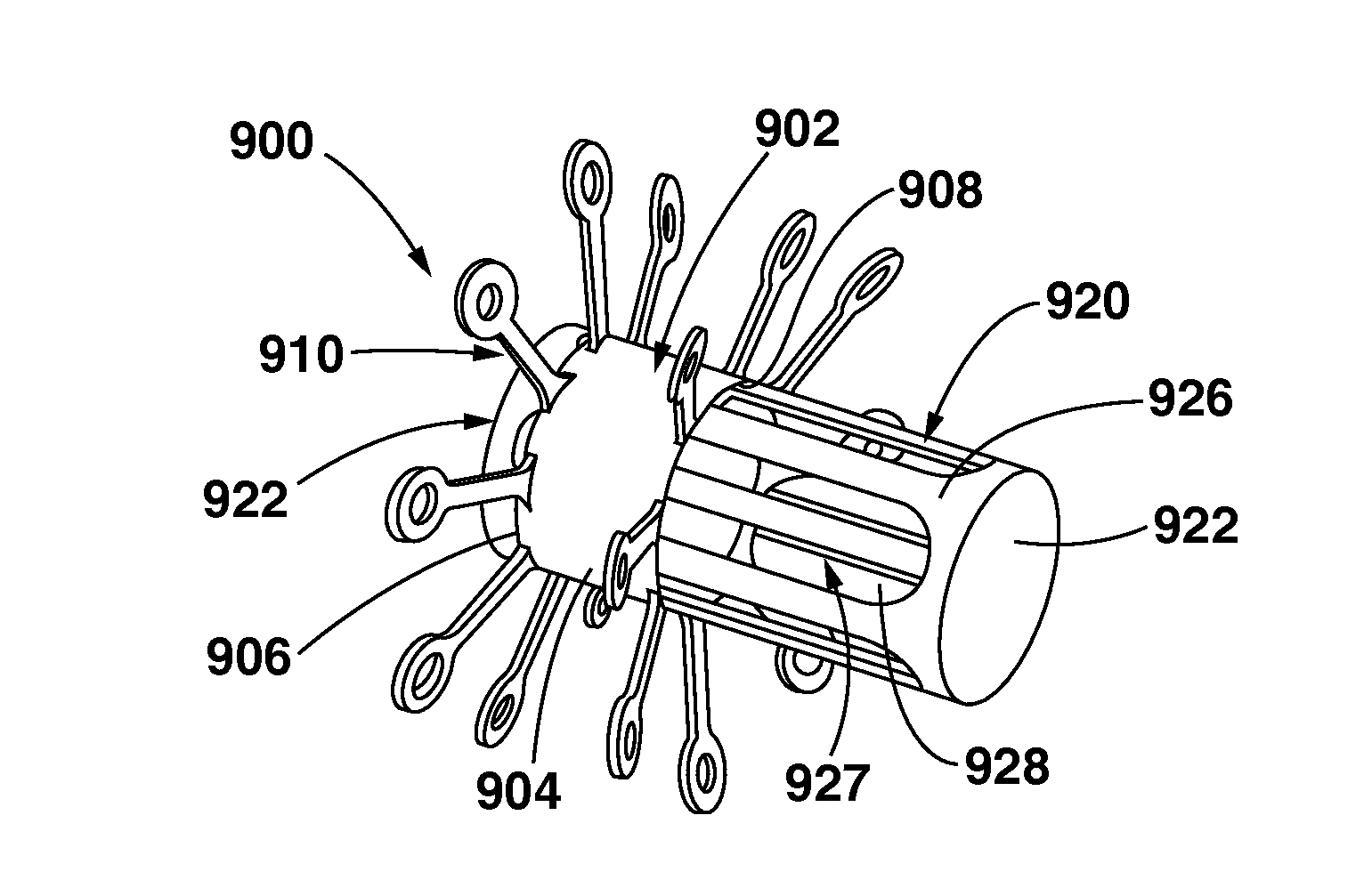 Arteriovenous Shunt Having a Moveable Valve