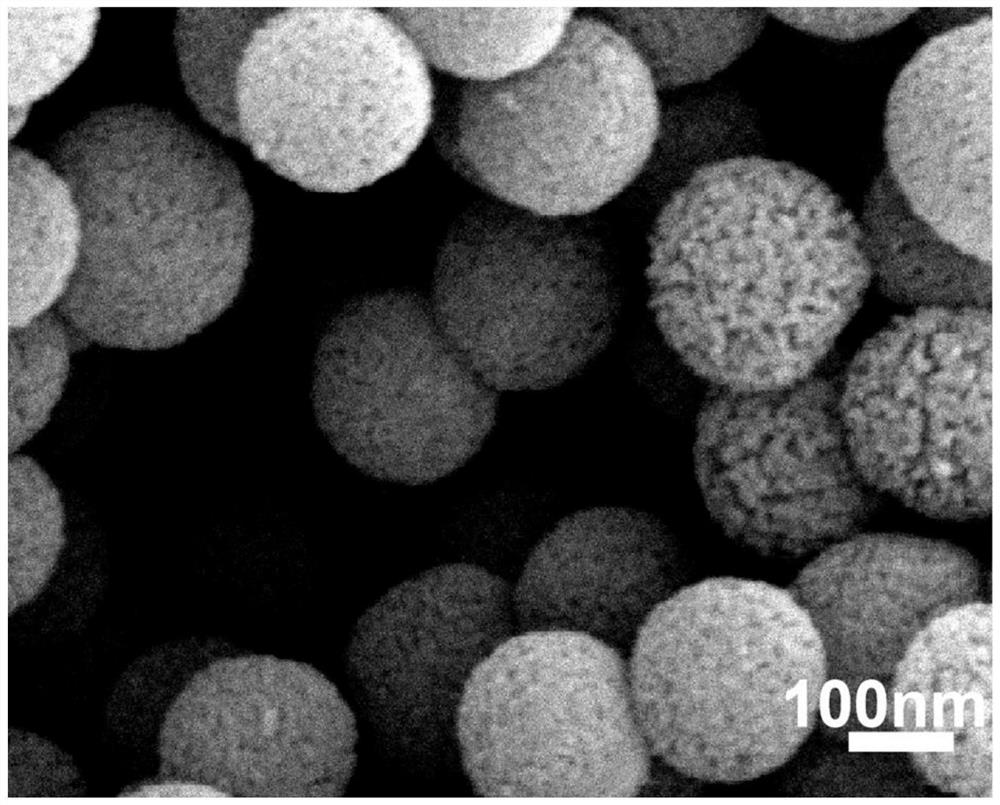 Preparation method of nano-mesoporous composite flexible membrane material for promoting blood vessel formation