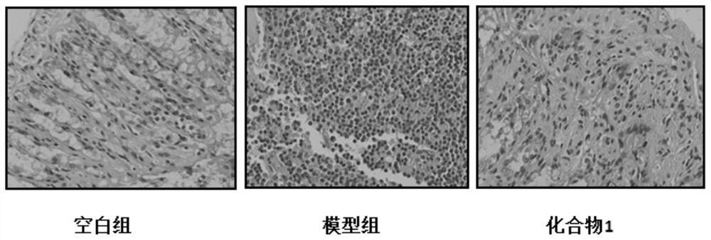 1, 2, 4-triazole derivative compound and application thereof in treating inflammatory bowel disease