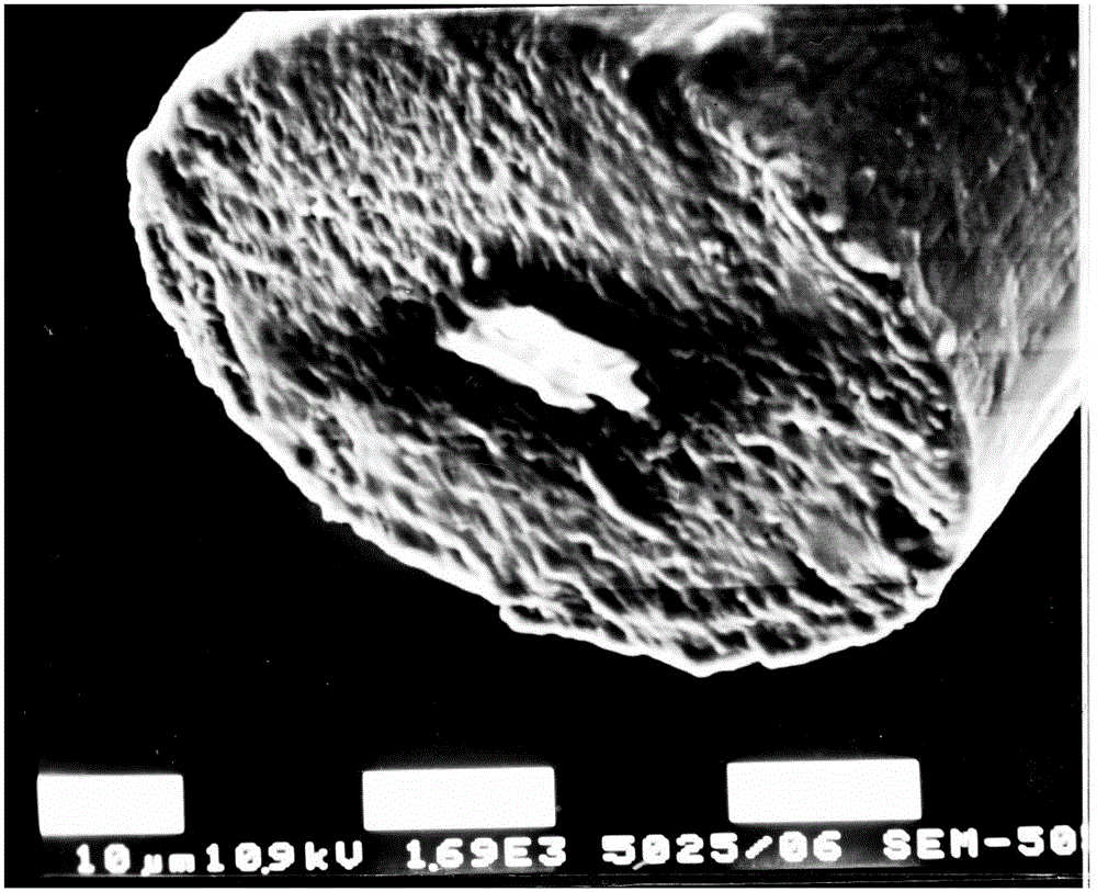 Keratin-chitosan composite medical dressing and preparation method thereof