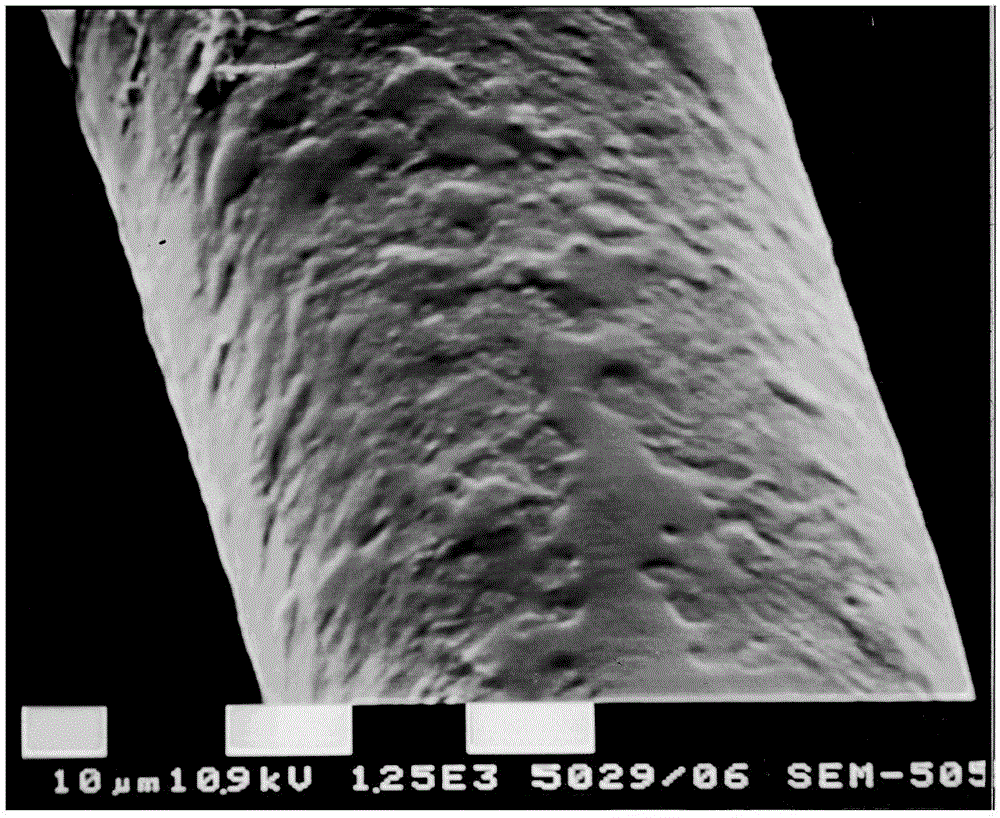 Keratin-chitosan composite medical dressing and preparation method thereof