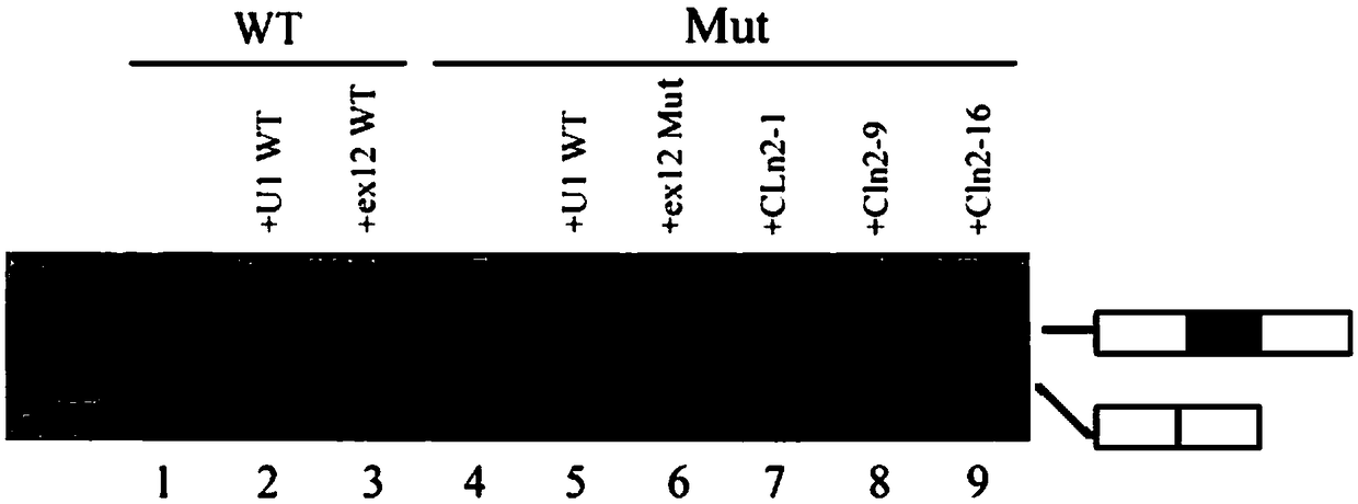 U1-snRNA for repairing TPP1 gene Pre-mRNA aberrant splicing and application of U1-snRNA