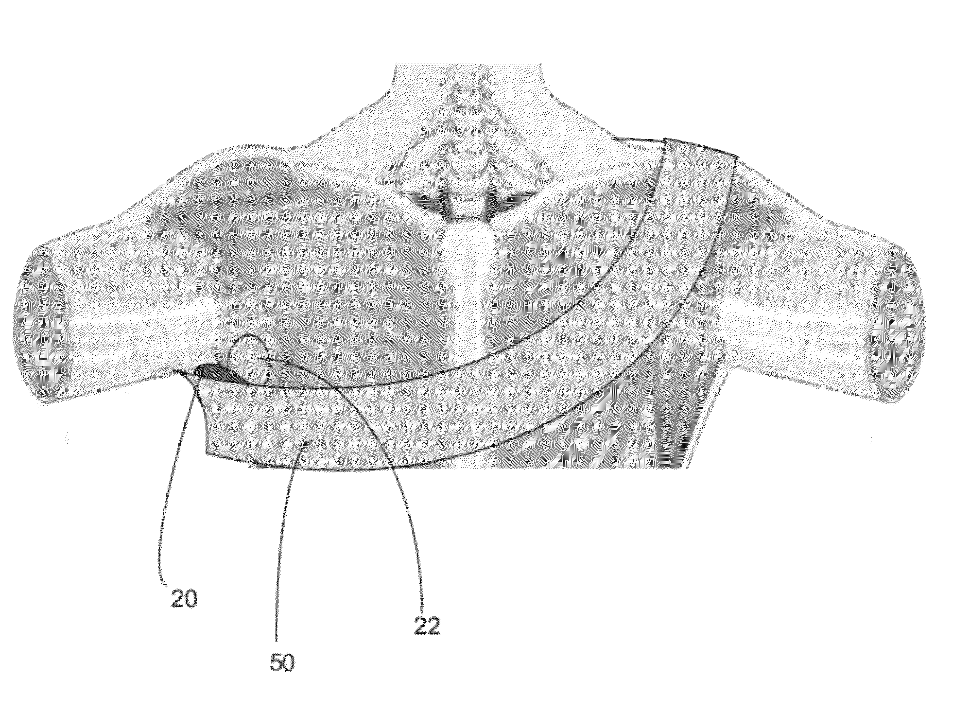 Apparatus and methods for controlling bleeding using externally applied pressure